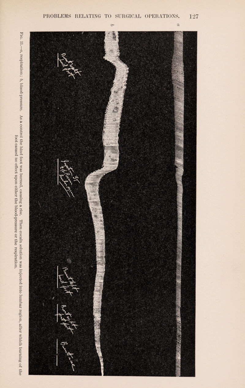 foot caused no effect upon either the blood-pressure or the respiration.