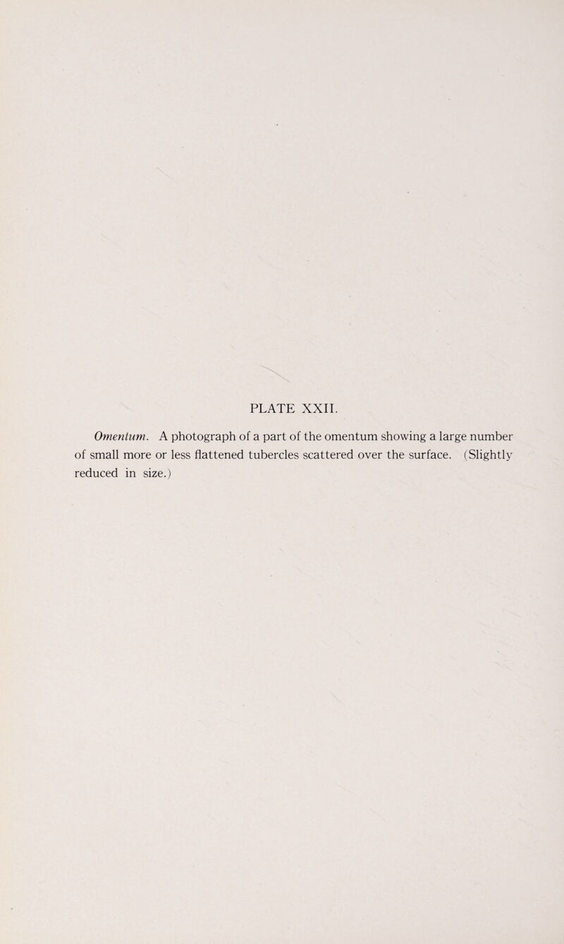Omentum. A photograph of a part of the omentum showing a large number of small more or less flattened tubercles scattered over the surface. (Slightly reduced in size.)