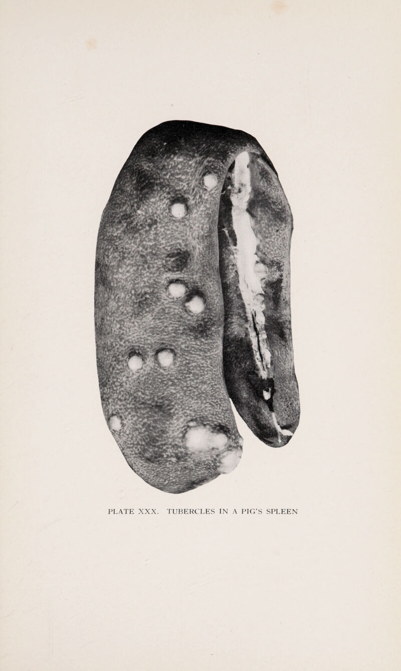 PLATE XXX. TUBERCLES IN A PIG’S SPLEEN