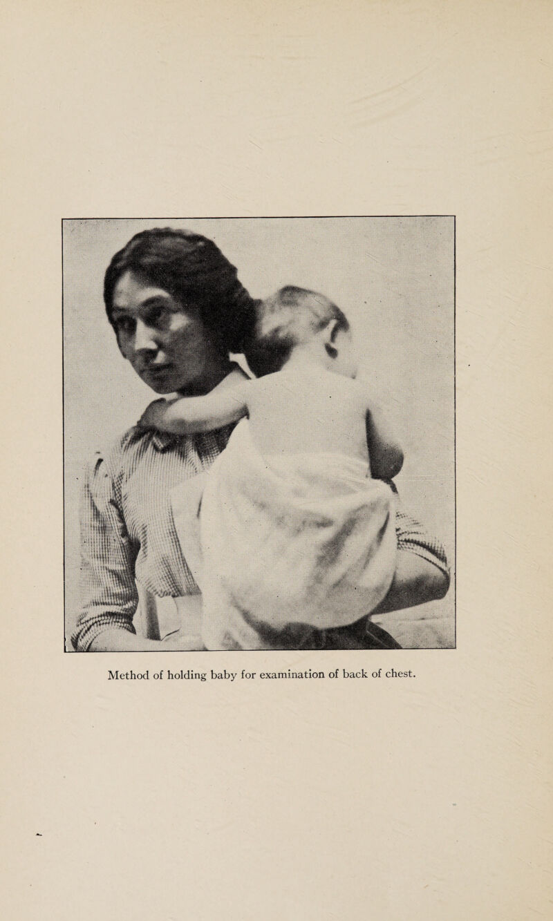 Method of holding baby for examination of back of chest.