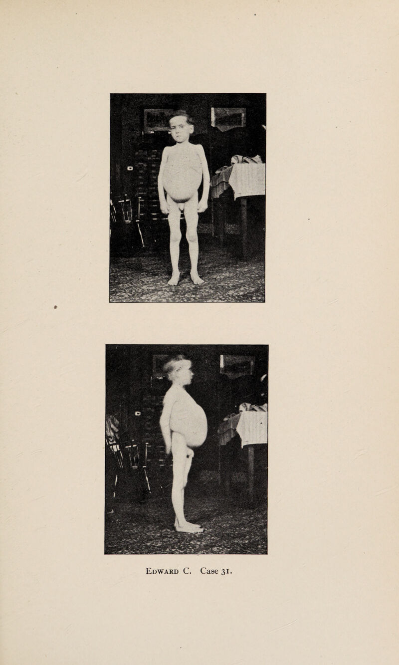 Edward C. Case 31