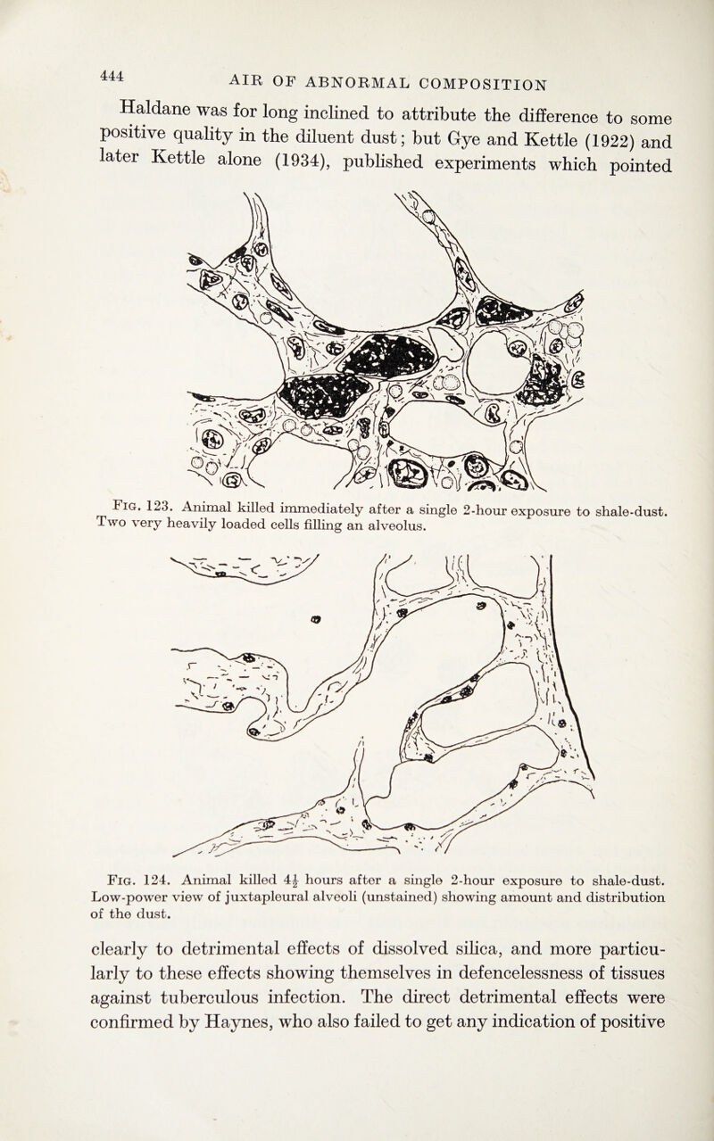 Haldane was for long inclined to attribute the difference to some positive quality in the diluent dust; but Gye and Kettle (1922) and later Kettle alone (1934), published experiments which pointed Fig. 123. Animal killed immediately after a single 2-hour exposure to shale-dust. Two very heavily loaded cells filling an alveolus. Fig. 124. Animal killed 4| hours after a single 2-hour exposure to shale-dust. Low-power view of juxtapleural alveoli (unstained) showing amount and distribution of the dust. clearly to detrimental effects of dissolved silica, and more particu¬ larly to these effects showing themselves in defencelessness of tissues against tuberculous infection. The direct detrimental effects were confirmed by Haynes, who also failed to get any indication of positive