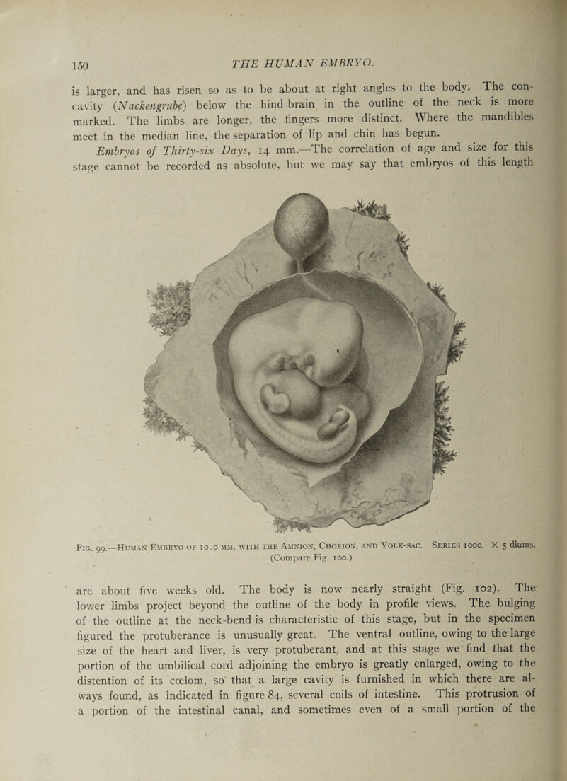 is larger, and has risen so as to be about at right angles to the body. The con¬ cavity (N acken grub e) below the hind-brain in the outline of the neck is more marked. The limbs are longer, the fingers more distinct. Where the mandibles meet in the median line, the separation of lip and chin has begun. Embryos of Thirty-six Days, 14 mm.—T he correlation of age and size for this stage cannot be recorded as absolute, but we may say that embryos of this length Fig. 99._Human Embryo of 10.o mm. with the Amnion, Chorion, and Yolk-sac. Series 1000. X 5 diams. (Compare Fig. ioo.) are about five weeks old. The body is now nearly straight (Fig. 102). The lower limbs project beyond the outline of the body in profile views. The bulging of the outline at the neck-bend is characteristic of this stage, but in the specimen figured the protuberance is unusually great. The ventral outline, owing to the large size of the heart and liver, is very protuberant, and at this stage we find that the portion of the umbilical cord adjoining the embryo is greatly enlarged, owing to the distention of its coelom, so that a large cavity is furnished in which there are al¬ ways found, as indicated in figure 84, several coils of intestine. This protrusion of a portion of the intestinal canal, and sometimes even of a small portion of the