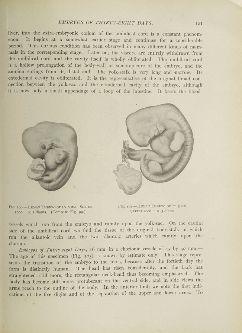 liver, into the extra-embryonic coelom of the umbilical cord is a constant phenom¬ enon. It begins at a somewhat earlier stage and continues for a considerable period. This curious condition has been observed in many different kinds of mam¬ mals in the corresponding stage. Later on, the viscera are entirely withdrawn from the umbilical cord and the cavity itself is wholly obliterated. The umbilical cord is a hollow prolongation of the body-wall or somatopleure of the embryo, and the amnion springs from its, distal end. The yolk-stalk is very long and narrow. Its entodermal cavity is obliterated. It is the representative of the original broad con¬ nection between the yolk-sac and the entodermal cavity of the embryo, although it is now only a small appendage of a loop of the intestine. It bears the blood- Fig. ioo.—Human Embryo of io.omm. Series Fig. ioi. Human Embryo of ii .5 mm. 1000. X 5 diams. (Compare Fig. 99.) Series 1006. X 5 diams. vessels which run from the embryo and ramify upon the yolk-sac. On the caudal side of the umbilical cord we find the tissue of the original body-stalk in which run the allantoic vein and the two allantoic arteries which ramify upon the chorion. Embryos of Thirty-eight Days, 16 mm. in a chorionic vesicle of 45 ^Y 4° mm.— The age of this specimen (Fig. 103) is known by estimate only. This stage repre¬ sents the transition of the embryo to the fetus, because after the fortieth day the form is distinctly human. The head has risen considerably, and the back has straightened still more, the rectangular neck-bend thus becoming emphasized. The body has become still more protuberant on the ventral side, and in side v iew s the arms reach to the outline of the body. In the anterior limb we note the first indi¬ cations of the five digits and of the separation of the upper and low er arms. I o