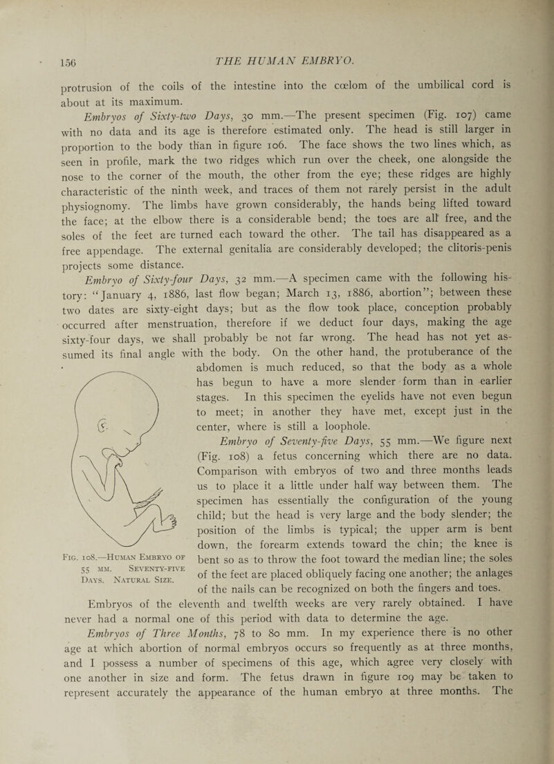 150 protrusion of the coils of the intestine into the coelom of the umbilical cord is about at its maximum. Embryos of Sixty-two Days, 30 mm.—The present specimen (Fig. 107) came with no data and its age is therefore estimated only. The head is still larger in proportion to the body than in figure 106. The face shows the two lines which, as seen in profile, mark the two ridges which run over the cheek, one alongside the nose to the corner of the mouth, the other from the eye; these ridges are highly characteristic of the ninth week, and traces of them not rarely persist in the adult physiognomy. The limbs have grown considerably, the hands being lifted toward the face; at the elbow there is a considerable bend; the toes are all free, and the soles of the feet are turned each toward the other. The tail has disappeared as a free appendage. The external genitalia are considerably developed; the clitoris-penis projects some distance. Embryo of Sixty-four Days, 32 mm.—A specimen came with the following his¬ tory: “ January 4, 1886, last flow began; March 13, 1886, abortion”; between these two dates are sixty-eight days; but as the flow took place, conception probably occurred after menstruation, therefore if we deduct four days, making the age sixty-four days, we shall probably be not far wrong. The head has not yet as¬ sumed its final angle with the body. On the other hand, the protuberance of the abdomen is much reduced, so that the body as a whole has begun to have a more slender form than in earlier stages. In this specimen the eyelids have not even begun to meet; in another they have met, except just in the center, where is still a loophole. Embryo of Seventy-five Days, 55 mm.—We figure next (Fig. 108) a fetus concerning which there are no data. Comparison with embryos of two and three months leads us to place it a little under half way between them. The specimen has essentially the configuration of the young child; but the head is very large and the body slender; the position of the limbs is typical; the upper arm is bent down, the forearm extends toward the chin; the knee is bent so as to throw the foot toward the median line; the soles of the feet are placed obliquely facing one another; the anlages of the nails can be recognized on both the fingers and toes. Embryos of the eleventh and twelfth weeks are very rarely obtained. I have never had a normal one of this period with data to determine the age. Embryos of Three Months, 78 to 80 mm. In my experience there is no other age at which abortion of normal embryos occurs so frequently as at three months, and I possess a number of specimens of this age, which agree very closely with one another in size and form. The fetus drawn in figure 109 may be taken to represent accurately the appearance of the human embryo at three months. I he Fig. 108.—Human Embryo of 55 mm. Seventy-five Days. Natural Size.