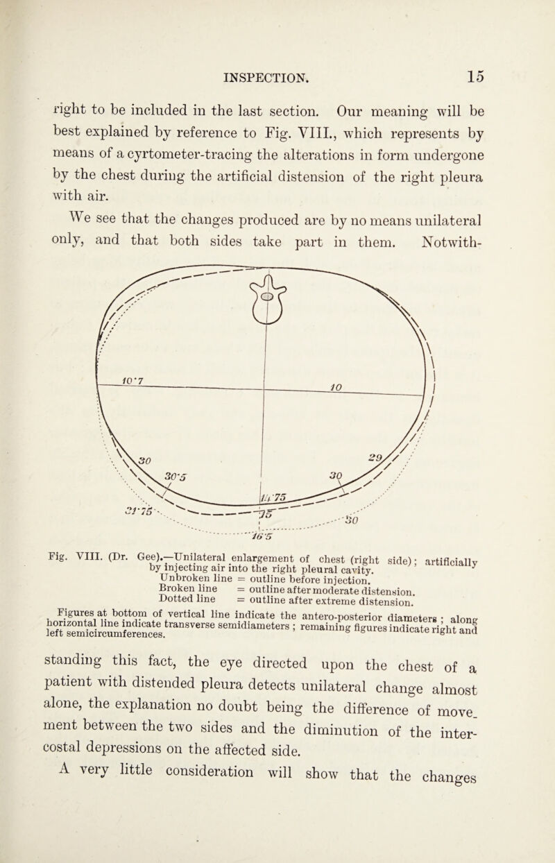 right to be included in the last section. Our meaning will be best explained by reference to Fig. VIII., which represents by means of a cyrtometer-tracing the alterations in form undergone by the chest during the artificial distension of the right pleura with air. We see that the changes produced are by no means unilateral only, and that both sides take part in them. Notwith- Fig. VIII. (Dr. Gee).—Unilateral enlargement of chest (right side) * by injecting air into the right pleural cavity. Unbroken line = outline before injection. Broken line = outline after moderate distension. Dotted line = outline after extreme distension. artificially Figures at bottom of vertical line indicate the antero-posterior diameters • alone- semidiameters ; “Mtatog figures indicate right and standing this fact, the eye directed upon the chest of a patient with distended pleura detects unilateral change almost alone, the explanation no doubt being the difference of move, ment between the two sides and the diminution of the inter¬ costal depressions on the affected side. A very little consideration will show that the changes