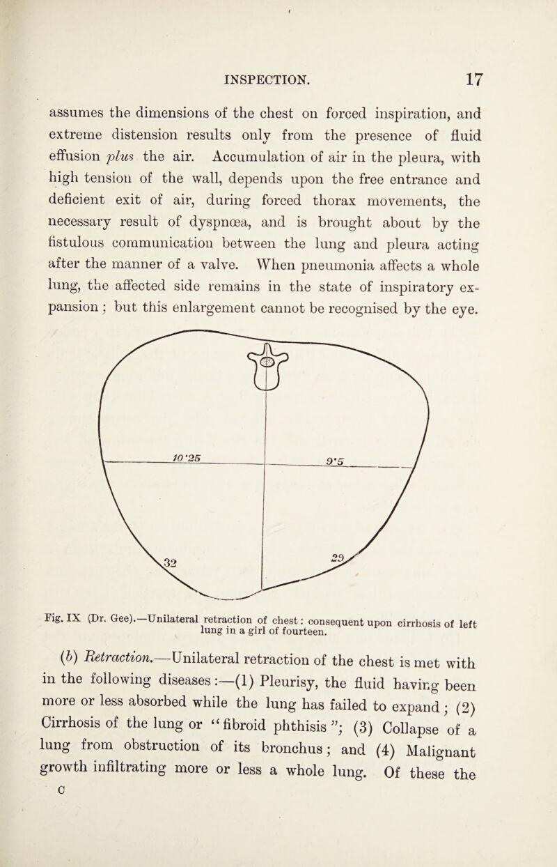 < INSPECTION. 17 assumes the dimensions of the chest on forced inspiration, and extreme distension results only from the presence of fluid effusion plus the air. Accumulation of air in the pleura, with high tension of the wall, depends upon the free entrance and deficient exit of air, during forced thorax movements, the necessary result of dyspnoea, and is brought about by the fistulous communication between the lung and pleura acting after the manner of a valve. When pneumonia affects a whole lung, the affected side remains in the state of inspiratory ex¬ pansion ; but this enlargement cannot be recognised by the eye. Fig. IX (Dr. Gee). Unilateral retraction of chest: consequent upon cirrhosis of left lung in a girl of fourteen. (b) Retraction.—Unilateral retraction of the chest is met with in the following diseases: (1) Pleurisy, the fluid having been more or less absorbed while the lung has failed to expand; (2) Cirrhosis of the lung or “fibroid phthisis”; (3) Collapse of a lung from obstruction of its bronchus; and (4) Malignant growth infiltrating more or less a whole lung. Of these the c