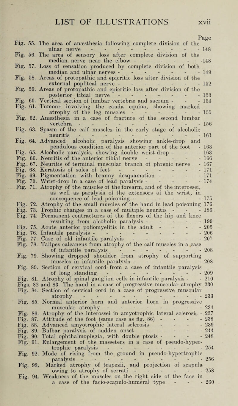 Page Fig. 55. The area of anaesthesia following complete division of the ulnar nerve.148 Fig. 56. The area of sensory loss after complete division of the median nerve near the elbow.148 Fig. 57. Loss of sensation produced by complete division of both median and ulnar nerves ------- 149 Fig. 58. Areas of protopathic and epicritic loss after division of the external popliteal nerve.- 152 Fig. 59. Areas of protopathic and epicritic loss after division of the posterior tibial nerve - - - - - - - 153 Fig. 60. Vertical section of lumbar vertebrae and sacrum - 154 Fig. 61. Tumour involving the cauda equina, showing marked atrophy of the leg muscles.-155 Fig. 62. Anaesthesia in a case of fracture of the second lumbar vertebra.156 Fig. 63. Spasm of the calf muscles in the early stage of alcoholic neuritis.161 Fig. 64. Advanced alcoholic paralysis showing ankle-drop and pendulous condition of the anterior part of the foot - 163 Fig. 65. Alcoholic paralysis, showing double wrist-drop - - - 163 Fig. 66. Neuritis of the anterior tibial nerve - - - - - 166 Fig. 67. Neuritis of terminal muscular branch of phrenic nerve - 167 Fig. 68. Keratosis of soles of feet ------- 171 Fig. 69. Pigmentation with branny desquamation - 171 Fig. 70. Wrist-drop in a case of lead paralysis ----- 174 Fig. 71. Atrophy of the muscles of the forearm, and of the interossei, as well as paralysis of the extensors of the wrist, in consequence of lead poisoning - - - - - -175 Fig. 72. Atrophy of the small muscles of the hand in lead poisoning 176 Fig. 73. Trophic changes in a case of multiple neuritis - - - 186 Fig. 74. Permanent contractures of the flexors of the hip and knee resulting from alcoholic paralysis ----- 199 Fig. 75. Acute anterior poliomyelitis in the adult ... - 205 Fig. 76. Infantile paralysis.- 206 Fig. 77. Case of old infantile paralysis.207 Fig. 78. Talipes calcaneus from atrophy of the calf muscles in a .case of infantile paralysis.208 Fig. 79. Showing dropped shoulder from atrophy of supporting muscles in infantile paralysis ------ 208 Fig. 80. Section of cervical cord from a case of infantile paralysis of long standing - -.209 Fig. 81. Atrophy of spinal ganglion cells in infantile paralysis - - 210 Figs. 82 and 83. The hand in a case of pi’ogressive muscular atrophy 230 Fig. 84. Section of cervical cord in a case of progressive muscular atrophy. 233 Fig. 85. Normal anterior horn and anterior horn in progressive muscular atrophy -------- 234 Fig. 86. Atrophy of the interossei in amyotrophic lateral sclerosis - 237 Fig. 87. Attitude of the foot (same case as fig. 86) - - - - 238 Fig. 88. Advanced amyotrophic lateral sclerosis - - - - 239 Fig. 89. Bulbar paralysis of sudden onset.244 Fig. 90. Total ophthalmoplegia, with double ptosis - - - - 248 Fig. 91. Enlargement of the masseters in a case of pseudo-hyper¬ trophic paralysis.254 Fig. 92. Mode of rising from the ground in pseudo-hypertrophic paralysis.256 Fig. 93. Marked atrophy of trapezii, and projection of scapula owing to atrophy of serrati.258 Fig. 94. Weakness of the muscles on the right side of the face in a case of the facio-scapulo-humeral type - - - 260