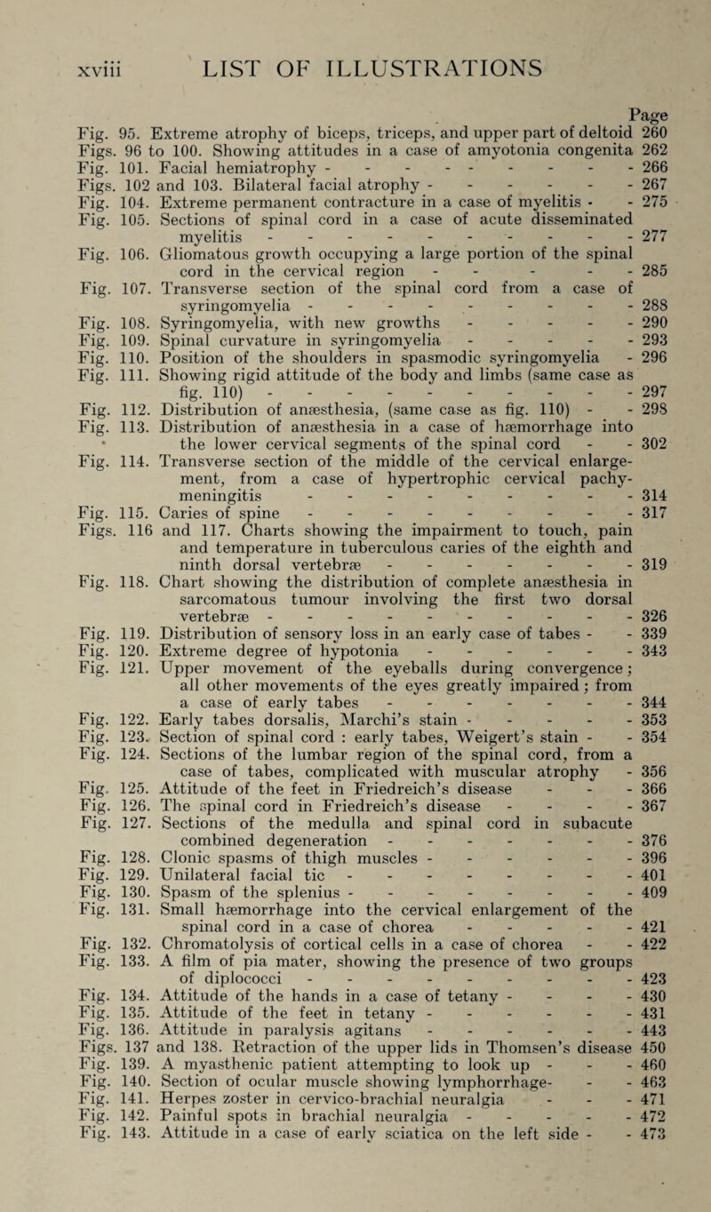 Page Fig. 95. Extreme atrophy of biceps, triceps, and upper part of deltoid 260 Figs. 96 to 100. Showing attitudes in a case of amyotonia congenita 262 Fig. 101. Facial hemiatrophy.266 Figs. 102 and 103. Bilateral facial atrophy.267 Fig. 104. Extreme permanent contracture in a case of myelitis - - 275 Fig. 105. Sections of spinal cord in a case of acute disseminated myelitis.. 277 Fig. 106. Gliomatous growth occupying a large portion of the spinal cord in the cervical region - - - - 285 Fig. 107. Transverse section of the spinal cord from a case of syringomyelia - - - -.288 Fig. 108. Syringomyelia, with new growths ----- 290 Fig. 109. Spinal curvature in syringomyelia.293 Fig. 110. Position of the shoulders in spasmodic syringomyelia - 296 Fig. 111. Showing rigid attitude of the body and limbs (same case as fig. 110) - -.297 Fig. 112. Distribution of anaesthesia, (same case as fig. 110) - - 298 Fig. 113. Distribution of anaesthesia in a case of haemorrhage into the lower cervical segments of the spinal cord - - 302 Fig. 114. Transverse section of the middle of the cervical enlarge¬ ment, from a case of hypertrophic cervical pachy¬ meningitis .314 Fig. 115. Caries of spine.- - - 317 Figs. 116 and 117. Charts showing the impairment to touch, pain and temperature in tuberculous caries of the eighth and ninth dorsal vertebrae.319 Fig. 118. Chart showing the distribution of complete anaesthesia in sarcomatous tumour involving the first two dorsal vertebrae.326 Fig. 119. Distribution of sensory loss in an early case of tabes - - 339 Fig. 120. Extreme degree of hypotonia.343 Fig. 121. Upper movement of the eyeballs during convergence; all other movements of the eyes greatly impaired ; from a case of early tabes.344 Fig. 122. Early tabes dorsalis, Marchi’s stain.353 Fig. 123. Section of spinal cord : early tabes, Weigert’s stain - - 354 Fig. 124. Sections of the lumbar region of the spinal cord, from a case of tabes, complicated with muscular atrophy - 356 Fig. 125. Attitude of the feet in Friedreich’s disease - - - 366 Fig. 126. The spinal cord in Friedreich’s disease - 367 Fig. 127. Sections of the medulla and spinal cord in subacute combined degeneration.376 Fig. 128. Clonic spasms of thigh muscles.396 Fig. 129. Unilateral facial tic.401 Fig. 130. Spasm of the splenius.409 Fig. 131. Small haemorrhage into the cervical enlargement of the spinal cord in a case of chorea.421 Fig. 132. Chromatolysis of cortical cells in a case of chorea - - 422 Fig. 133. A film of pia mater, showing the presence of two groups of diplococci.423 Fig. 134. Attitude of the hands in a case of tetany - 430 Fig. 135. Attitude of the feet in tetany ------ 431 Fig. 136. Attitude in paralysis agitans.443 Figs. 137 and 138. Retraction of the upper lids in Thomsen’s disease 450 Fig. 139. A myasthenic patient attempting to look up - - - 460 Fig. 140. Section of ocular muscle showing lymphorrhage- - - 463 Fig. 141. Herpes zoster in cervico-brachial neuralgia - - - 471 Fig. 142. Painful spots in brachial neuralgia.472 Fig. 143. Attitude in a case of early sciatica on the left side - - 473