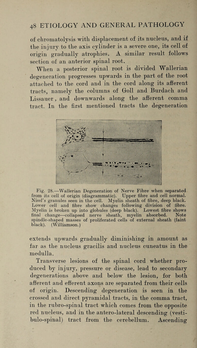 of chromatolysis with displacement of its nucleus, and if the injury to the axis cylinder is a severe one, its cell of origin gradually atrophies. A similar result follows section of an anterior spinal root. When a posterior spinal root is divided Wallerian degeneration progresses upwards in the part of the root attached to the cord and in the cord along its afferent tracts, namely the columns of Goll and Burdach and Lissauer, and downwards along the afferent comma tract. In the first mentioned tracts the degeneration Fig. 28.—Wallerian Degeneration of Nerve Fibre when separated from its cell of origin (diagrammatic). Upper fibre and cell normal. Nissl’s granules seen in the cell. Myelin sheath of fibre, deep black. Lower cell and fibre show changes following division of fibre. Myelin is broken up into globules (deep black). Lowest fibre shows final change—collapsed nerve sheath, myelin absorbed. Note spindle-shaped masses of proliferated cells of external sheath (faint black). (Williamson.) extends upwards gradually diminishing in amount as far as the nucleus gracilis and nucleus cuneatus in the medulla. Transverse lesions of the spinal cord whether pro¬ duced by injury, pressure or disease, lead to secondary degenerations above and below the lesion, for both afferent and efferent axons are separated from their cells of origin. Descending degeneration is seen in the crossed and direct pyramidal tracts, in the comma tract, in the rubro-spinal tract which comes from the opposite red nucleus, and in the antero-lateral descending (vesti- bulo-spinal) tract from the cerebellum. Ascending