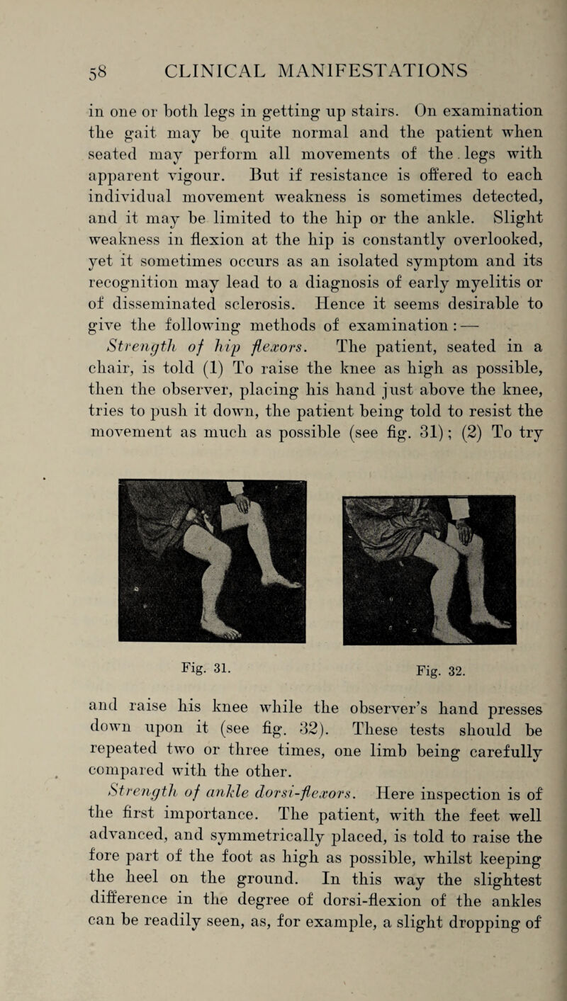 in one or both legs in getting up stairs. On examination the gait may be quite normal and the patient when seated may perform all movements of the. legs with apparent vigour. But if resistance is offered to each individual movement weakness is sometimes detected, and it may be limited to the hip or the ankle. Slight weakness in flexion at the hip is constantly overlooked, yet it sometimes occurs as an isolated symptom and its recognition may lead to a diagnosis of early myelitis or of disseminated sclerosis. Hence it seems desirable to give the following methods of examination : — Strength of hip flexors. The patient, seated in a chair, is told (.1) To raise the knee as high as possible, then the observer, placing his hand just above the knee, tries to push it down, the patient being told to resist the movement as. much as possible (see fig. 31); (2) To try Fig. 31. Fig. 32. and raise his knee while the observer’s hand presses down upon it (see fig. 32). These tests should be repeated two or three times, one limb being carefully compared with the other. Strength of ankle dor si-flexors. Here inspection is of the first importance. The patient, with the feet well advanced, and symmetrically placed, is told to raise the fore part of the foot as high as possible, whilst keeping the heel on the ground. In this way the slightest difference in the degree of dorsi-flexion of the ankles can be readily seen, as, for example, a slight dropping of