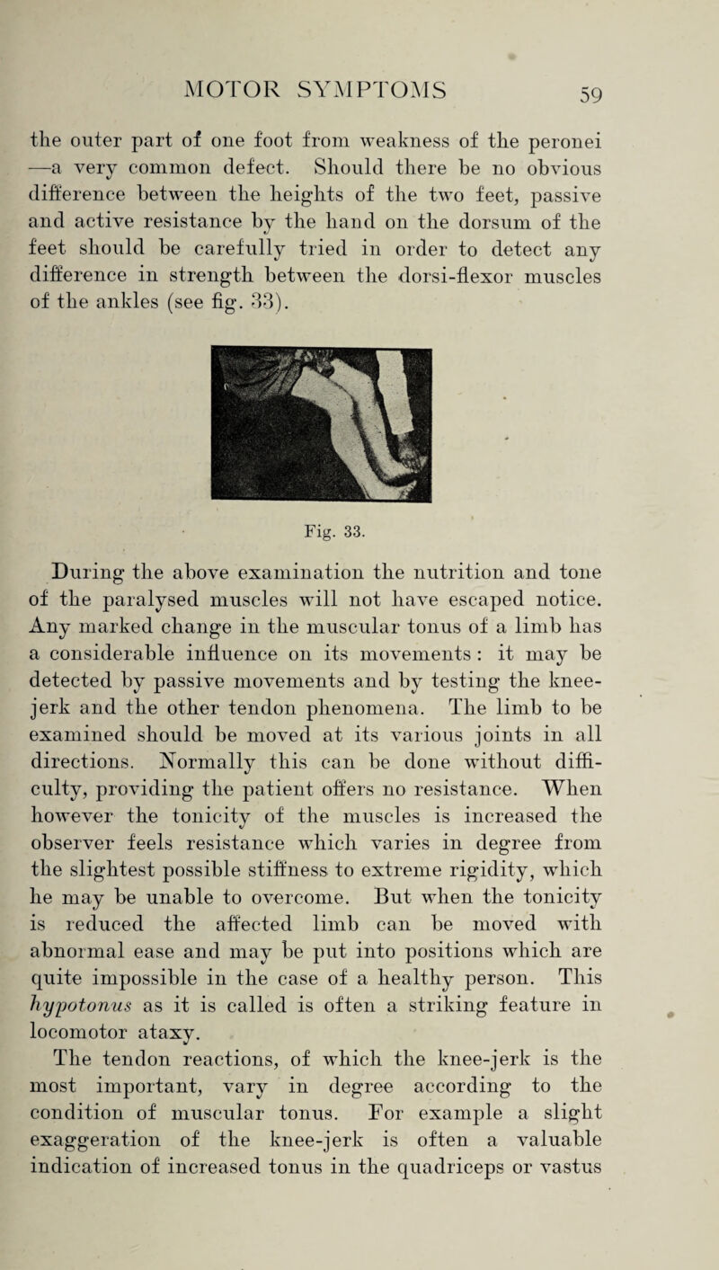 the outer part of one foot from weakness of the peronei —a very common defect. Should there be no obvious difference between the heights of the two feet, passive and active resistance by the hand on the dorsum of the feet should be carefully tried in order to detect any difference in strength between the dorsi-flexor muscles of the ankles (see fig. 33). Fig. 33. During the above examination the nutrition and tone of the paralysed muscles will not have escaped notice. Any marked change in the muscular tonus of a limb lias a considerable influence on its movements : it may be detected by passive movements and by testing the knee- jerk and the other tendon phenomena. The limb to be examined should be moved at its various joints in all directions. Normally this can be done without diffi¬ culty, providing the patient offers no resistance. When however the tonicity of the muscles is increased the observer feels resistance which varies in degree from the slightest possible stiffness to extreme rigidity, which he may be unable to overcome. But when the tonicity is reduced the affected limb can be moved with abnormal ease and may be put into positions which are quite impossible in the case of a healthy person. This hyyotonus as it is called is often a striking feature in locomotor ataxy. The tendon reactions, of which the knee-jerk is the most important, vary in degree according to the condition of muscular tonus. For example a slight exaggeration of the knee-jerk is often a valuable indication of increased tonus in the quadriceps or vastus