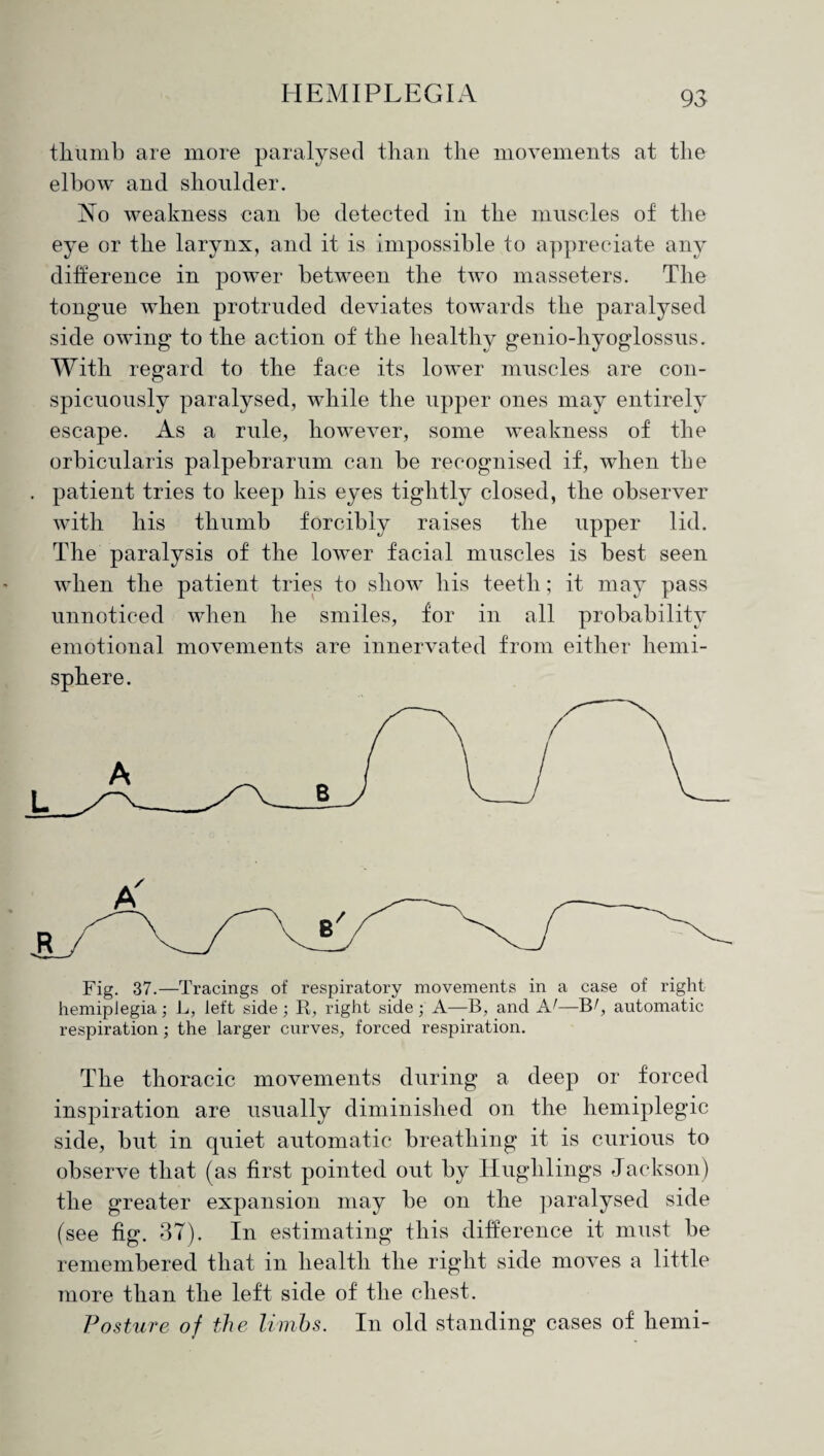 thumb are more paralysed than the movements at the elbow and shoulder. No weakness can be detected in the muscles of the eye or the larynx, and it is impossible to appreciate any difference in power between the two masseters. The tongue when protruded deviates towards the paralysed side owing to the action of the healthy genio-liyoglossus. With regard to the face its lower muscles are con¬ spicuously paralysed, while the upper ones may entirely escape. As a rule, however, some weakness of the orbicularis palpebrarum can be recognised if, when the patient tries to keep his eyes tightly closed, the observer with his thumb forcibly raises the upper lid. The paralysis of the lower facial muscles is best seen when the patient tries to show his teeth; it may pass unnoticed when he smiles, for in all probability emotional movements are innervated from either hemi¬ sphere. Fig. 37.—Tracings of respiratory movements in a case of right hemiplegia; L, left side ; R, right side; A—B, and —B/, automatic respiration; the larger curves, forced respiration. The thoracic movements during a deep or forced inspiration are usually diminished on the hemiplegic side, but in quiet automatic breathing it is curious to observe that (as first pointed out by Hughlings Jackson) the greater expansion may be on the paralysed side (see fig. 37). In estimating this difference it must be remembered that in health the right side moves a little more than the left side of the chest. Posture of the limbs. In old standing cases of hemi-