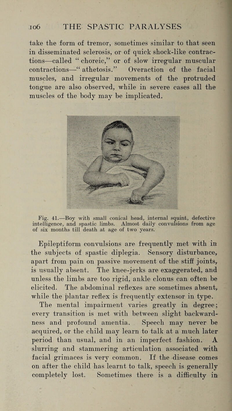 take the form of tremor, sometimes similar to that seen in disseminated sclerosis, or of quick shock-like contrac¬ tions—called “choreic,” or of slow irregular muscular contractions—“ athetosis.” Over action of the facial muscles, and irregular movements of the protruded tongue are also observed, while in severe cases all the muscles of the body may be implicated. Fig. 41.—Boy with small conical head, internal squint, defective intelligence, and spastic limbs. Almost daily convulsions from age of six months till death at age of two years. Epileptiform convulsions are frequently met with in the subjects of spastic diplegia. Sensory disturbance,, apart from pain on passive movement of the stiff joints, is usually absent. The knee-jerks are exaggerated, and unless the limbs are too rigid, ankle clonus can often be elicited. The abdominal reflexes are sometimes absent, while the plantar reflex is frequently extensor in type. The mental impairment varies greatly in degree; every transition is met with between slight backward¬ ness and profound amentia. Speech may never be acquired, or the child may learn to talk at a much later period than usual, and in an imperfect fashion. A slurring and stammering articulation associated with facial grimaces is very common. If the disease comes on after the child has learnt to talk, speech is generally completely lost. Sometimes there is a difficulty in