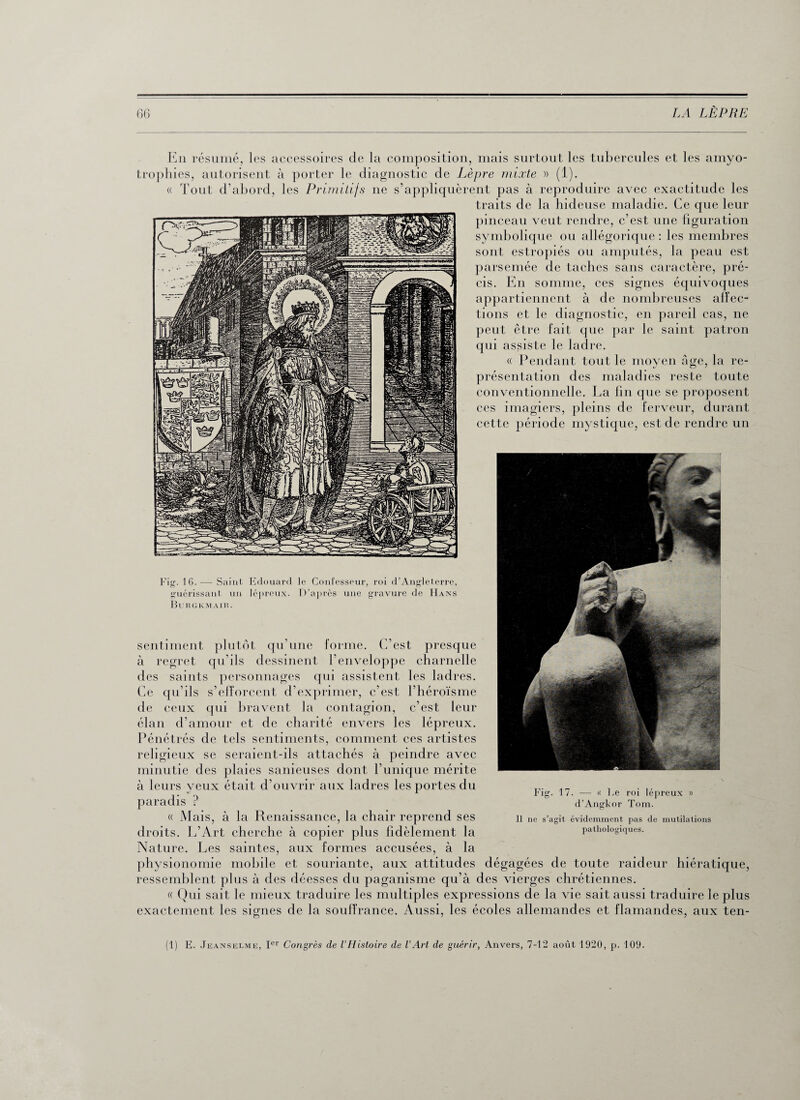 En résumé, les accessoires de la composition, mais surtout les tubercules et les amyo- trophies, autorisent à porter le diagnostic de Lèpre mixte » (1). « Tout d’abord, les Primitifs ne s’appliquèrent pas à reproduire avec exactitude les traits de la hideuse maladie. Ce que leur pinceau veut rendre, c’est une figuration symbolique ou allégorique : les membres sont estropiés ou amputés, la peau est parsemée de taches sans caractère, pré¬ cis. En somme, ces signes équivoques appartiennent à de nombreuses affec¬ tions et le diagnostic, en pareil cas, ne peut être fait que par le saint patron qui assiste le ladre. « Pendant tout le moyen âge, la re¬ présentation des maladies reste toute conventionnelle. La fin que se proposent ces imagiers, pleins de ferveur, durant cette période mystique, est de rendre un Fig. 16. — Saint Edouard le Confesseur, roi d’Angleterre, guérissant un lépreux. D’après une gravure de Hans Burgkmaih. sentiment plutôt qu’une forme. C’est presque à regret qu’ils dessinent l’enveloppe charnelle des saints personnages qui assistent les ladres. Ce qu’ils s’efforcent d’exprimer, c’est l’héroïsme de ceux qui bravent la contagion, c’est leur élan d’amour et de charité envers les lépreux. Pénétrés de tels sentiments, comment ces artistes religieux se seraient-ils attachés à peindre avec minutie des plaies sanieuses dont fumque mérite à leurs yeux était d’ouvrir aux ladres les portes du paradis ? « Mais, à la Renaissance, la chair reprend ses droits. L’Art cherche à copier plus fidèlement la Nature. Les saintes, aux formes accusées, à la physionomie mobile et souriante, aux attitudes dégagées de toute raideur hiératique, ressemblent plus à des déesses du paganisme qu’à des vierges chrétiennes. « Qui sait le mieux traduire les multiples expressions de la vie sait aussi traduire le plus exactement les signes de la souffrance. Aussi, les écoles allemandes et flamandes, aux ten- 17. — « Ee roi lépreux d’Angkor Tom. Il ne s’agit évidemment pas de mutilations pathologiques. (1) E. Jeanselme, Ier Congrès de l’Histoire de l’Art de guérir, Anvers, 7-12 août 1920, p. 109.