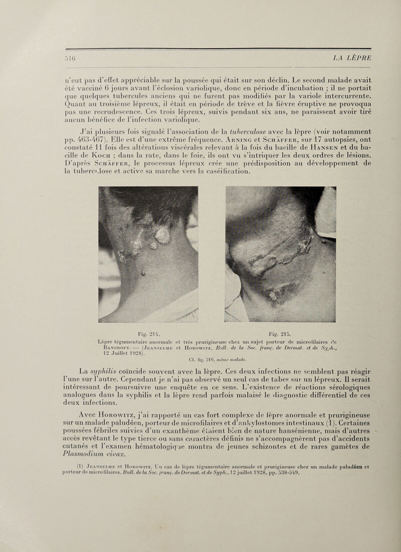 n’eut pas d’effet appréciable sur la poussée qui était sur son déclin. Le second malade avait été vacciné 6 jours avant l'éclosion variolique, donc en période d’incubation ; il ne portait que quelques tubercules anciens qui 11e furent pas modifiés par la variole intercurrente. Quant au troisième lépreux, il était en période de trêve et la fièvre éruptive ne provoqua pas une recrudescence. Ces trois lépreux, suivis pendant six ans, ne paraissent avoir tiré aucun bénéfice de l’infection variolique. J’ai plusieurs fois signalé l'association de la tuberculose avec la lèpre (voir notamment pp. 463-467). Elle est d’une extrême fréquence. Àrning et Schaffer, sur 17 autopsies, ont constaté 11 fois des altérations viscérales relevant à la fois du bacille de Hansen et du ba¬ cille de Koch ; dans la rate, dans le foie, ils ont vu s’intriquer les deux ordres de lésions. D’après Schaffer, le processus lépreux crée une prédisposition au développement de la tuberculose et active sa marche vers la caséification. Fig. 214. Fig. 215. Lèpre tégumentaire anormale et très prurigineuse chez un sujet porteur «le micro Pilaires de Bancroft. — (Jeanselme et Horowitz, Bull, (le la Soc. franç. de Dermat. et de Syyh., 12 Juillet 1928). Cf. fig. 216, même malade. La syphilis coïncide souvent avec la lèpre. Ces deux infections ne semblent pas réagir l’une sur l’autre. Cependant je n’ai pas observé un seul cas de tabes sur un lépreux. Il serait intéressant de poursuivre une enquête en ce sens. L’existence de réactions sérologiques analogues dans la syphilis et la lèpre rend parfois malaisé le diagnostic différentiel de ces deux infections. Avec Horowitz, j’ai rapporté un cas fort complexe de ièpre anormale et prurigineuse sur un malade paludéen, porteur de microfilaires et d’ankylostomes intestinaux (1). Certaines poussées fébriles suivies d’un exanthème é Paient bien de nature hansénienne, mais d’autres accès revêtant le type tierce ou sans caractères définis ne s’accompagnèrent pas d’accidents cutanés et l’examen hématologique montra de jeunes schizontes et de rares gamètes de Plasmodium vivax. (1) Jeanselme et IIorowitz, Un cas de lèpre tégumentaire anormale et prurigineuse chez un malade paludéen et porteur de micro filaires. Bull, delà Soc. jranç. de Dermat. et de Sypli., 12 juillet 1928, pp. 538-549.