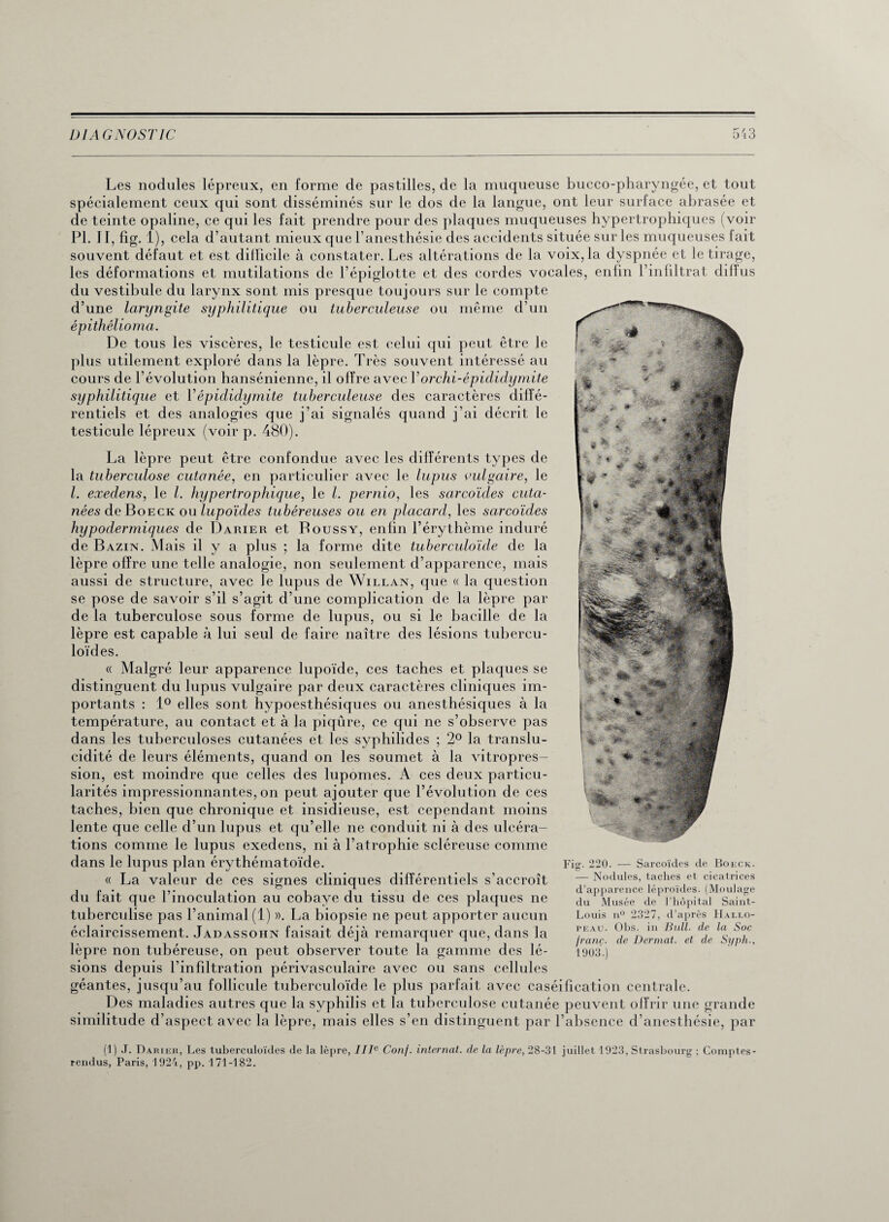 Les nodules lépreux, en forme de pastilles, de la muqueuse bucco-pharyngée, et tout spécialement ceux qui sont disséminés sur le dos de la langue, ont leur surface abrasée et de teinte opaline, ce qui les fait prendre pour des plaques muqueuses hypertrophiques (voir PL II, fig. 1), cela d’autant mieux que l’anesthésie des accidents située sur les muqueuses fait souvent défaut et est difficile à constater. Les altérations de la voix, la dyspnée et le tirage, les déformations et mutilations de l’épiglotte et des cordes vocales, enfin l’in filtrat dilïus du vestibule du larynx sont mis presque toujours sur le compte d’une laryngite syphilitique ou tuberculeuse ou même d’un épithélioma. De tous les viscères, le testicule est celui qui peut être le plus utilement exploré dans la lèpre. Très souvent intéressé au cours de l’évolution hansénienne, il offre avec Vorchi-épididymite syphilitique et Y épididymite tuberculeuse des caractères diffé¬ rentiels et des analogies que j’ai signalés quand j’ai décrit le testicule lépreux (voir p. 480). La lèpre peut être confondue avec les différents types de la tuberculose cutanée, en particulier avec le lupus vulgaire, le l. execlens, le l. hypertrophique, le l. pernio, les sarcoïdes cuta¬ nées de Boeck ou lupoïcles tubéreuses ou en placard, les sarcoïdes hypodermiques de Darier et Roussy, enfin l’érythème induré de Bazin. Mais il y a plus ; la forme dite tuberculoïde de la lèpre offre une telle analogie, non seulement d’apparence, mais aussi de structure, avec le lupus de Willan, que « la question se pose de savoir s’il s’agit d’une complication de la lèpre par de la tuberculose sous forme de lupus, ou si le bacille de la lèpre est capable à lui seul de faire naître des lésions tubercu¬ loïdes. « Malgré leur apparence lupoïde, ces taches et plaques se distinguent du lupus vulgaire par deux caractères cliniques im¬ portants : 1° elles sont hypoesthésiques ou anesthésiques à la température, au contact et à la piqûre, ce qui ne s’observe pas dans les tuberculoses cutanées et les syphilides ; 2° la translu¬ cidité de leurs éléments, quand on les soumet à la vitropres¬ sion, est moindre que celles des lupomes. A ces deux particu¬ larités impressionnantes, on peut ajouter que l’évolution de ces taches, bien que chronique et insidieuse, est cependant moins lente que celle d’un lupus et qu’elle ne conduit ni à des ulcéra¬ tions comme le lupus exedens, ni à l’atrophie scléreuse comme dans le lupus plan érythématoïde. « La valeur de ces signes cliniques différentiels s’accroît du fait que l’inoculation au cobaye du tissu de ces plaques ne tuberculise pas l’animal (1) ». La biopsie ne peut apporter aucun éclaircissement. Jadassohn faisait déjà remarquer que, dans la lèpre non tubéreuse, on peut observer toute la gamme des lé¬ sions depuis l’infiltration périvasculaire avec ou sans cellules géantes, jusqu’au follicule tuberculoïde le plus parfait avec caséification centrale. Des maladies autres que la syphilis et la tuberculose cutanée peuvent offrir une grande similitude d’aspect avec la lèpre, mais elles s’en distinguent par l’absence d’anesthésie, par (1) J. Dariek, Les tuberculoïdes de la lèpre, IIIe Conf. internat, de la lèpre, 28-31 juillet 1923, Strasbourg ; Comptes- rendus, Paris, 1924, pp. 171-182. Fia-. 220. — Sarcoïdes de Boeck. “ > m — Nodules, taches et cicatrices d’apparence léproïdes. (Moulage du Musée de l’hôpital Saint- Louis n° 2327, d’après Hallo¬ peau. Obs. in Bull- de la Soc franc, de Dermat. et de Syph., 1903.)