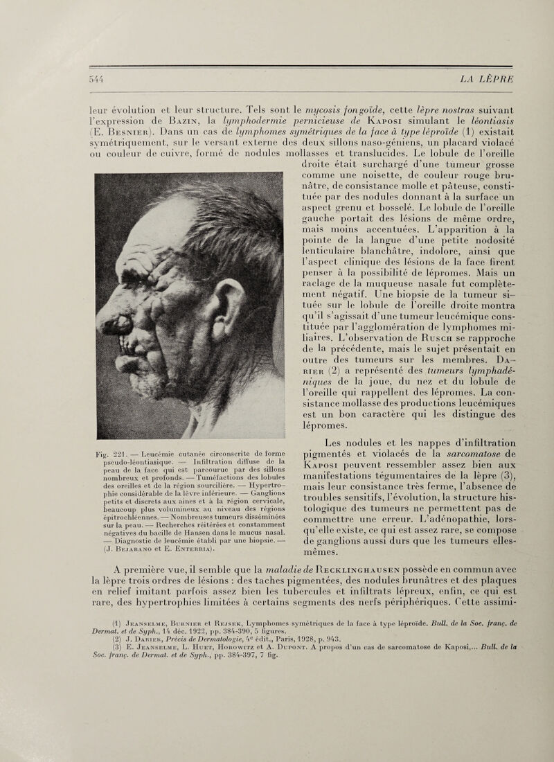 leur évolution et leur structure. Tels sont le mycosis fongoïde, cette lèpre nostras suivant l’expression de Bazin, la lymphodermie pernicieuse cle Kaposi simulant le lêonticisis (E. Besnier). Dans un cas de lymphomes symétriques de la face à type léproïde (1) existait symétriquement, sur le versant externe des deux sillons naso-géniens, un placard violacé ou couleur de cuivre, formé de nodules mollasses et translucides. Le lobule de l’oreille Fig. 221. — Leucémie cutanée circonscrite de forme pseudo-léontiasique. — Infiltration diffuse de la peau de la face qui est parcourue par des sillons nombreux et profonds. — Tuméfactions des lobules des oreilles et de la région sourcilière. — Hypertro¬ phie considérable de la lèvre inférieure. — Ganglions petits et discrets aux aines et à la région cervicale, beaucoup plus volumineux au niveau des régions épitrochléennes. — Nombreuses tumeurs disséminées sur la peau. — Recherches réitérées et constamment négatives du bacille de Hansen dans le mucus nasal. — Diagnostic de leucémie établi par une biopsie. — (J. Bejarano et E. Enterria). droite était surchargé d’une tumeur grosse comme une noisette, de couleur rouge bru¬ nâtre, de consistance molle et pâteuse, consti¬ tuée par des nodules donnant à la surface un aspect grenu et bosselé. Le lobule de l’oreille gauche portait des lésions de même ordre, mais moins accentuées. L’apparition à la pointe de la langue d’une petite nodosité lenticulaire blanchâtre, indolore, ainsi que l’aspect clinique des lésions de la face firent penser à la possibilité de lépromes. Mais un raclage de la muqueuse nasale fut complète¬ ment négatif. Une biopsie de la tumeur si¬ tuée sur le lobule de l’oreille droite montra qu’il s’agissait d’une tumeur leucémique cons¬ tituée par l’agglomération de lymphomes mi¬ liaires. L’observation de Rusch se rapproche de la précédente, mais le sujet présentait en outre des tumeurs sur les membres. Da— rier (2) a représenté des tumeurs lymphadé- niques de la joue, du nez et du lobule de l’oreille qui rappellent des lépromes. La con¬ sistance mollasse des productions leucémiques est un bon caractère qui les distingue des lépromes. Les nodules et les nappes d’infiltration pigmentés et violacés de la sarcomatose de Kaposi peuvent ressembler assez bien aux manifestations tégumentaires de la lèpre (3), mais leur consistance très ferme, l’absence de troubles sensitifs, l’évolution, la structure his¬ tologique des tumeurs ne permettent pas de commettre une erreur. L’adénopathie, lors¬ qu’elle existe, ce qui est assez rare, se compose de ganglions aussi durs que les tumeurs elles- mêmes. A première vue, il semble que la maladie de Recklinghausen possède en commun avec la lèpre trois ordres de lésions : des taches pigmentées, des nodules brunâtres et des plaques en relief imitant parfois assez bien les tubercules et infiltrats lépreux, enfin, ce qui est rare, des hypertrophies limitées à certains segments des nerfs périphériques. Cette assimi- (1) Jeanselme, Burnier et Rejsek, Lymphomes symétriques de la face à type léproïde. Bull, de la Soe. jranç. de Dermat. et de Syph., 14 déc. 1922, pp. 384-390, 5 figures. (2) J. Darier, Précis de Dermatologie, 4e édit., Paris, 1928, p. 943. (3) E. Jeanselme, L. Huet, Horowitz et A. Dupont. A propos d’un cas de sarcomatose de Kaposi,... Bull, de la Soc. jranç. de Dermat. et de Syph-, pp. 384-397, 7 fig.