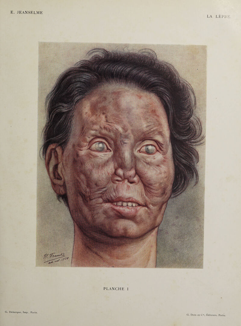 LA LEPRE PLANCHE I Deberque, lmp.. Paris.