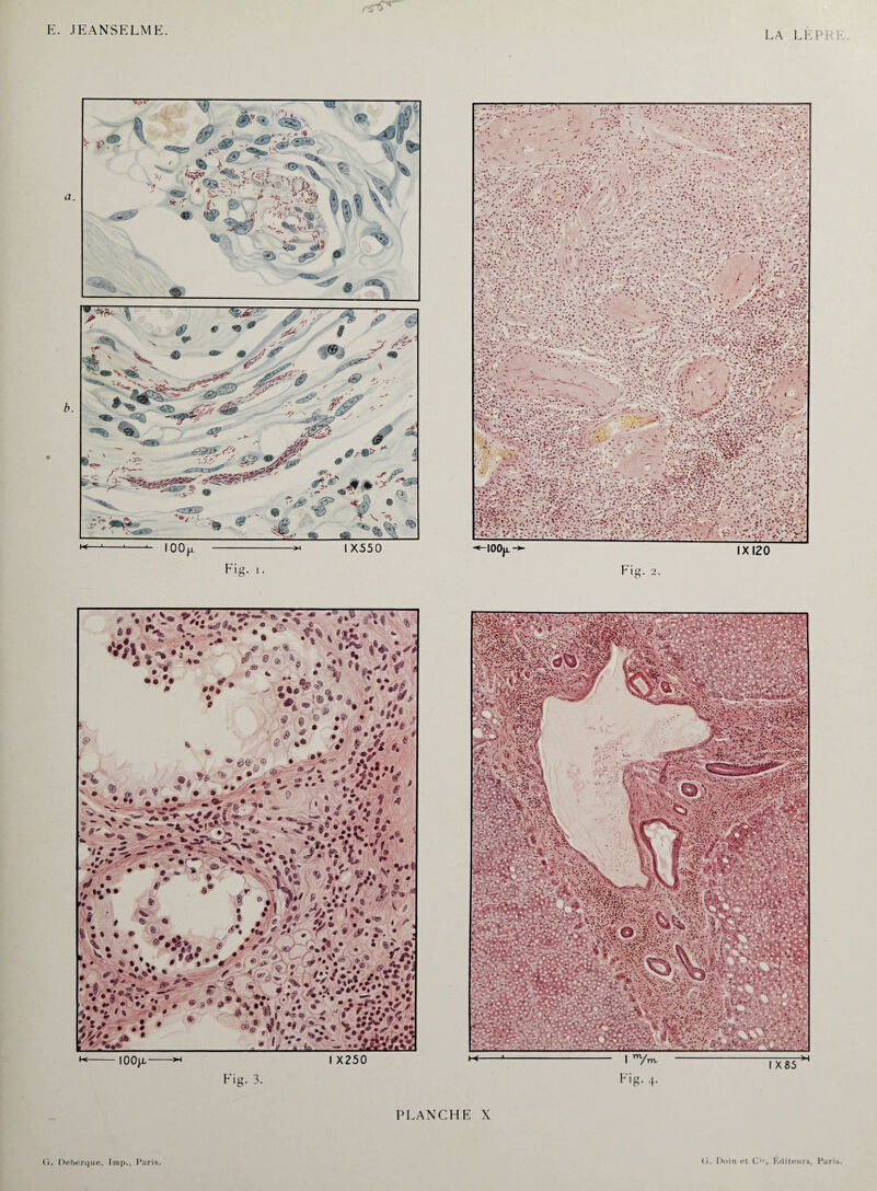 LA LEP ^ IOO|i -w 1X550 Fi a & Fi^. 2. O PLANCHE X