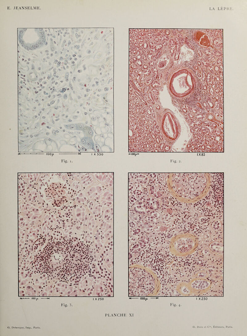 LA LEPRE. K-4- 100 E -x I X 250 Fig. 3. PLANCHE XI