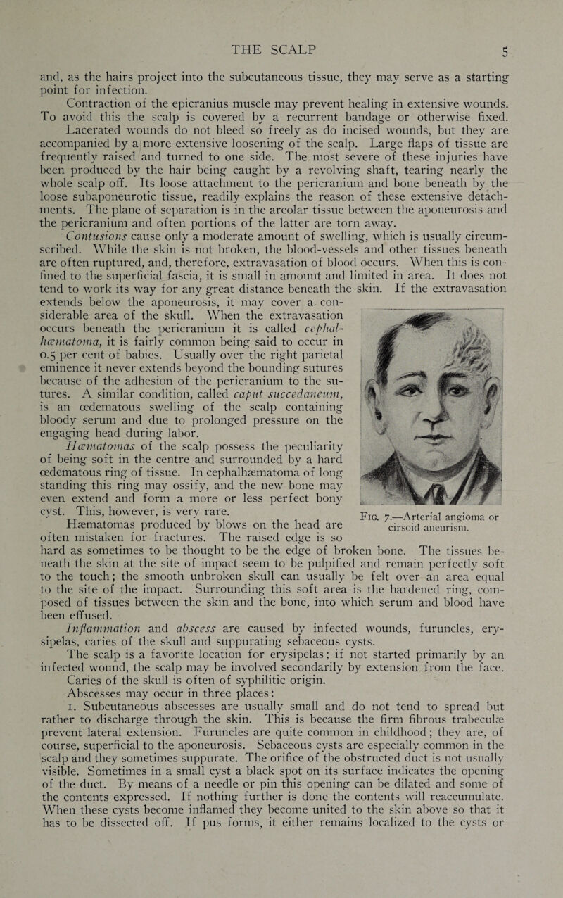 and, as the hairs project into the subcutaneous tissue, they may serve as a starting point for infection. Contraction of the epicranius muscle may prevent healing in extensive wounds. To avoid this the scalp is covered by a recurrent bandage or otherwise fixed. Lacerated wounds do not bleed so freely as do incised wounds, but they are accompanied by a more extensive loosening of the scalp. Large flaps of tissue are frequently raised and turned to one side. The most severe of these injuries have been produced by the hair being caught by a revolving shaft, tearing nearly the whole scalp off. Its loose attachment to the pericranium and bone beneath by the loose subaponeurotic tissue, readily explains the reason of these extensive detach¬ ments. The plane of separation is in the areolar tissue between the aponeurosis and the pericranium and often portions of the latter are torn away. Contusions cause only a moderate amount of swelling, which is usually circum¬ scribed. While the skin is not broken, the blood-vessels and other tissues beneath are often ruptured, and, therefore, extravasation of blood occurs. When this is con¬ fined to the superficial fascia, it is small in amount and limited in area. It does not tend to work its way for any great distance beneath the skin. If the extravasation extends below the aponeurosis, it may cover a con¬ siderable area of the skull. When the extravasation occurs beneath the pericranium it is called cephal¬ hematoma, it is fairly common being said to occur in 0.5 per cent of babies. Usually over the right parietal eminence it never extends beyond the bounding sutures because of the adhesion of the pericranium to the su¬ tures. A similar condition, called caput succedaneum, is an cedematous swelling of the scalp containing bloody serum and due to prolonged pressure on the engaging head during labor. Hematomas of the scalp possess the peculiarity of being soft in the centre and surrounded by a hard cedematous ring of tissue. In cephalhsematoma of long standing this ring may ossify, and the new bone may even extend and form a more or less perfect bony cyst. This, however, is very rare. Haematomas produced by blows on the head are often mistaken for fractures. The raised edge is so hard as sometimes to be thought to be the edge of broken bone. The tissues be¬ neath the skin at the site of impact seem to be pulpified and remain perfectly soft to the touch; the smooth unbroken skull can usually be felt over an area equal to the site of the impact. Surrounding this soft area is the hardened ring, com¬ posed of tissues between the skin and the bone, into which serum and blood have been effused. Inflammation and abscess are caused by infected wounds, furuncles, ery¬ sipelas, caries of the skull and suppurating sebaceous cysts. The scalp is a favorite location for erysipelas; if not started primarily by an infected wound, the scalp may be involved secondarily by extension from the face. Caries of the skull is often of syphilitic origin. Abscesses may occur in three places: 1. Subcutaneous abscesses are usually small and do not tend to spread but rather to discharge through the skin. This is because the firm fibrous trabeculae prevent lateral extension. Furuncles are quite common in childhood; they are, of course, superficial to the aponeurosis. Sebaceous cysts are especially common in the scalp and they sometimes suppurate. The orifice of the obstructed duct is not usually visible. Sometimes in a small cyst a black spot on its surface indicates the opening of the duct. By means of a needle or pin this opening can be dilated and some of the contents expressed. If nothing further is done the contents will reaccumulate. When these cysts become inflamed they become united to the skin above so that it has to be dissected off. If pus forms, it either remains localized to the cysts or cirsoid aneurism.