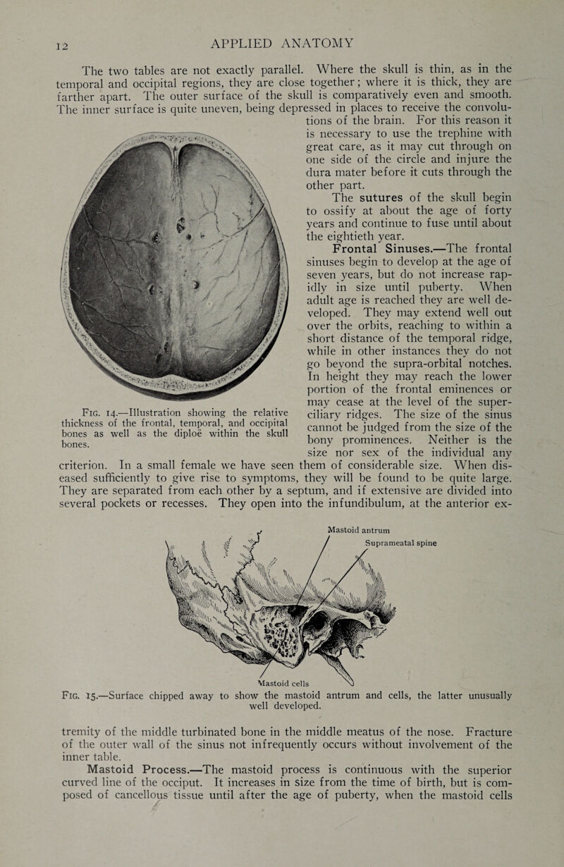 The two tables are not exactly parallel. Where the skull is thin, as in the temporal and occipital regions, they are close together; where it is thick, they are farther apart. The outer surface of the skull is comparatively even and smooth. The inner surface is quite uneven, being depressed in places to receive the convolu¬ tions of the brain. For this reason it is necessary to use the trephine with great care, as it may cut through on one side of the circle and injure the dura mater before it cuts through the other part. The sutures of the skull begin to ossify at about the age of forty years and continue to fuse until about the eightieth year. Frontal Sinuses.—The frontal sinuses begin to develop at the age of seven years, but do not increase rap¬ idly in size until puberty. When adult age is reached they are well de¬ veloped. They may extend well out over the orbits, reaching to within a short distance of the temporal ridge, while in other instances they do not go beyond the supra-orbital notches. In height they may reach the lower portion of the frontal eminences or may cease at the level of the super¬ ciliary ridges. The size of the sinus cannot be judged from the size of the bony prominences. Neither is the size nor sex of the individual any criterion. In a small female we have seen them of considerable size. When dis¬ eased sufficiently to give rise to symptoms, they will be found to be quite large. They are separated from each other by a septum, and if extensive are divided into several pockets or recesses. They open into the infundibulum, at the anterior ex- Fig. 14.—Illustration showing the relative thickness of the frontal, temporal, and occipital bones as well as the diploe within the skull bones. Fig. 15.—Surface chipped away to show the mastoid antrum and cells, the latter unusually well developed. tremity of the middle turbinated bone in the middle meatus of the nose. Fracture of the outer wall of the sinus not infrequently occurs without involvement of the inner table. Mastoid Process.—The mastoid process is continuous with the superior curved line of the occiput. It increases in size from the time of birth, but is com¬ posed of cancellous tissue until after the age of puberty, when the mastoid cells