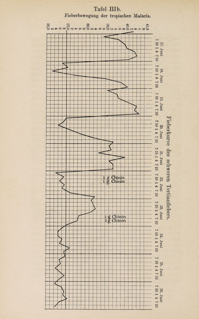 Tafel III b. Fieberbewegung der tropischen Malaria Fieberkurve des schweren Tertianfiebers. 17. Juni 18. Juni 19. Juni 20. Juni 21. Juni 22. Juni 23. Juni 24. Juni 25. Juni 26. Juni