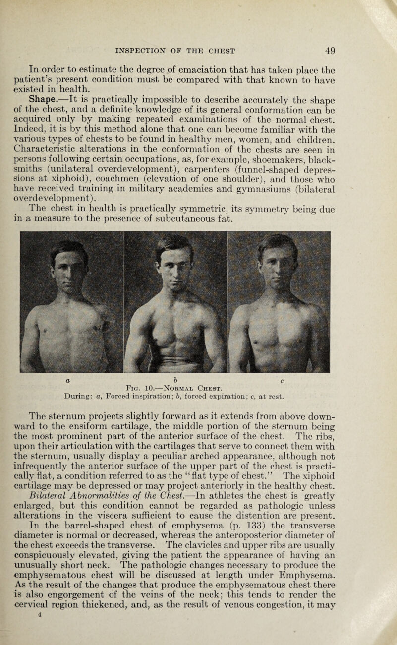 In order to estimate the degree of emaciation that has taken place the patient’s present condition must be compared with that known to have existed in health. Shape.—It is practically impossible to describe accurately the shape of the chest, and a definite knowledge of its general conformation can be acquired only by making repeated examinations of the normal chest. Indeed, it is by this method alone that one can become familiar with the various types of chests to be found in healthy men, women, and children. Characteristic alterations in the conformation of the chests are seen in persons following certain occupations, as, for example, shoemakers, black¬ smiths (unilateral overdevelopment), carpenters (funnel-shaped depres¬ sions at xiphoid), coachmen (elevation of one shoulder), and those who have received training in military academies and gymnasiums (bilateral overdevelopment). The chest in health is practically symmetric, its symmetry being due in a measure to the presence of subcutaneous fat. a b c Fig. 10.—Normal Chest. During: a, Forced inspiration; b, forced expiration; c, at rest. The sternum projects slightly forward as it extends from above down¬ ward to the ensiform cartilage, the middle portion of the sternum being the most prominent part of the anterior surface of the chest. The ribs, upon their articulation with the cartilages that serve to connect them with the sternum, usually display a peculiar arched appearance, although not infrequently the anterior surface of the upper part of the chest is practi¬ cally flat, a condition referred to as the “flat type of chest.” The xiphoid cartilage may be depressed or may project anteriorly in the healthy chest. Bilateral Abnormalities of the Chest.—In athletes the chest is greatly enlarged, but this condition cannot be regarded as pathologic unless alterations in the viscera sufficient to cause the distention are present. In the barrel-shaped chest of emphysema (p. 133) the transverse diameter is normal or decreased, whereas the anteroposterior diameter of the chest exceeds the transverse. The clavicles and upper ribs are usually conspicuously elevated, giving the patient the appearance of having an unusually short neck. The pathologic changes necessary to produce the emphysematous chest will be discussed at length under Emphysema. As the result of the changes that produce the emphysematous chest there is also engorgement of the veins of the neck; this tends to render the cervical region thickened, and, as the result of venous congestion, it may 4