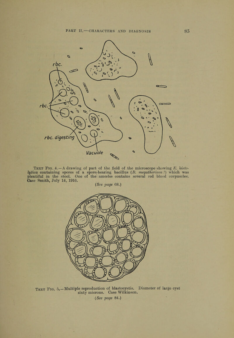 rbc. digesting Vacuole Text Fig. 4.—A drawing of part of the field of the microscope showing E. histo¬ lytica containing spores of a spore-bearing bacillus (B. megatherium ?) which was plentiful in the stool. One of the amoebse contains several red blood corpuscles. Case Smith, July 14, 1916. (See page 68.) Text Fig. 5.—Multiple reproduction of blastocystis. Diameter of large cyst sixty microns. Case Wilkinson. (See page 84.)