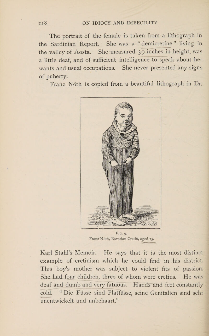 The portrait of the female is taken from a lithograph in the Sardinian Report. She was a “ demicretine ” living in the valley of Aosta. She measured 39 inches in height, was a little deaf, and of sufficient intelligence to speak about her wants and usual occupations. She never presented any signs of puberty. Franz Noth is copied from a beautiful lithograph in Dr. Fig. 9. Franz Noth, Bavarian Cretin, aged 15. Karl Stahl’s Memoir. He says that it is the most distinct example of cretinism which he could find in his district. This boy’s mother was subject to violent fits of passion. She had four children, three of whom were cretins. He was deaf and dumb and very fatuous. Hands and feet constantly cold. “ Die Fiisse sind Platftisse, seine Genitalien sind sehr unentwickelt und unbehaart.”