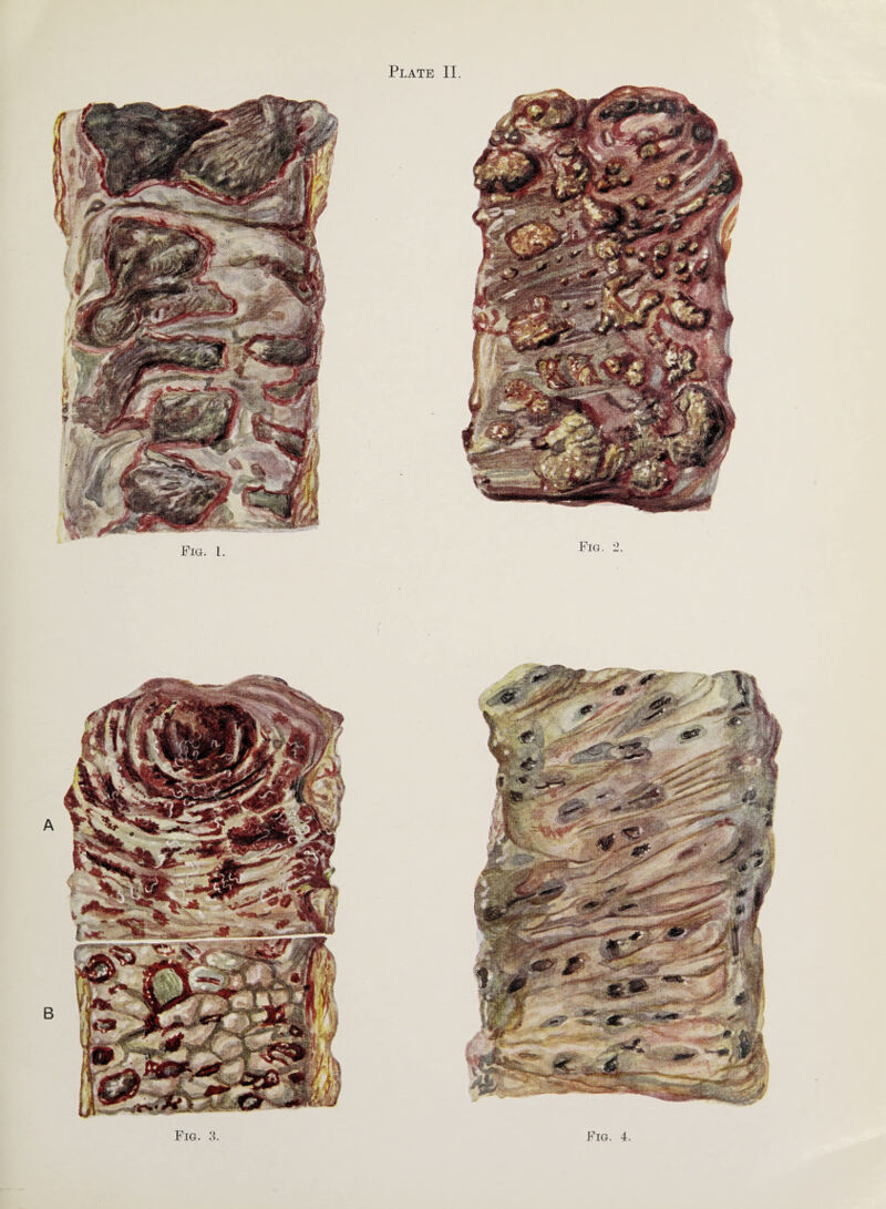 mHPtsmt Fig. 1. Fig. 2.