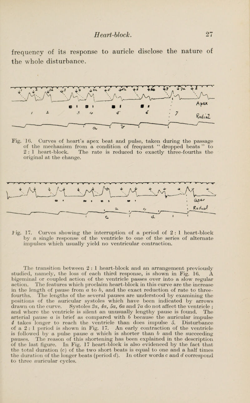 frequency of its response to auricle disclose the nature of the whole disturbance. Fig. 16. Curves of heart’s apex beat and pulse, taken during the passage of the mechanism from a condition of frequent “ dropped beats ” to 2 : 1 heart-block. The rate is reduced to exactly three-fourths the original at the change. big. 17. Curves showing the interruption of a period of 2 : 1 heart-block by a single response of the ventricle to one of the series of alternate impulses which usually yield no ventricular contraction. The transition between 2 : 1 heart-block and an arrangement previously studied, namely, the loss of each third response, is shown in Fig. 16. A bigeminal or coupled action of the ventricle passes over into a slow regular action. The features which proclaim heart-block in this curve are the increase in the length of pause from a to b, and the exact reduction of rate to three- fourths. The lengths of the several pauses are understood by examining the positions of the auricular systoles which have been indicated by arrows drawn on the curve. Systoles 2a, 4a, 5a, 6a and 7a do not affect the ventricle ; and where the ventricle is silent an unusually lengthy pause is fomid. The arterial pause a is brief as compared with b because the auricular impulse 4 takes longer to reach the ventricle than does impulse 5. Disturbance of a 2 : 1 period is shown in Fig. 17. An early contraction of the ventricle is followed by a pulse pause a wThich is shorter than b and the succeeding pauses. The reason of this shortening has been explained in the description of the last figure. In Fig. 17 heart-block is also evidenced by the fact that the total duration (c) of the two short beats is equal to one and a half times the duration of the longer beats (period d). In other words c and d correspond to three auricular cycles.