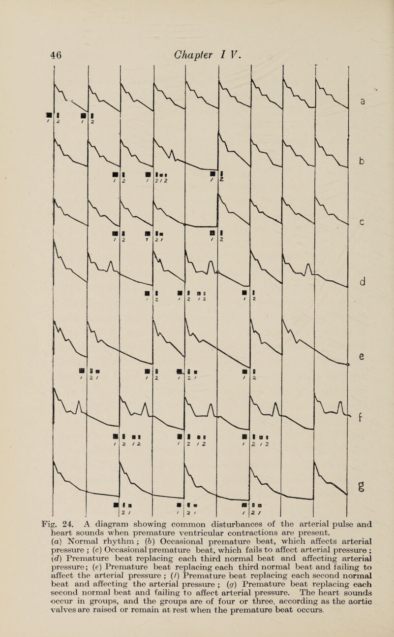 a b c d e f g Fig. 24. A diagram showing common disturbances of the arterial pulse and heart sounds when premature ventricular contractions are present. (a) Normal rhythm ; (b) Occasional premature beat, which affects arterial pressure ; (c) Occasional premature beat, which fails to affect arterial pressure ; id) Premature beat replacing each third normal beat and affecting arterial pressure; (e) Premature beat replacing each third normal beat and failing to affect the arterial pressure ; (/) Premature beat replacing each second normal beat and affecting the arterial pressure ; (g) Premature beat replacing each second normal beat and failing to affect arterial pressure. The heart sounds occur in groups, and the groups are of four or three, according as the aortic valves are raised or remain at rest when the premature beat occurs.