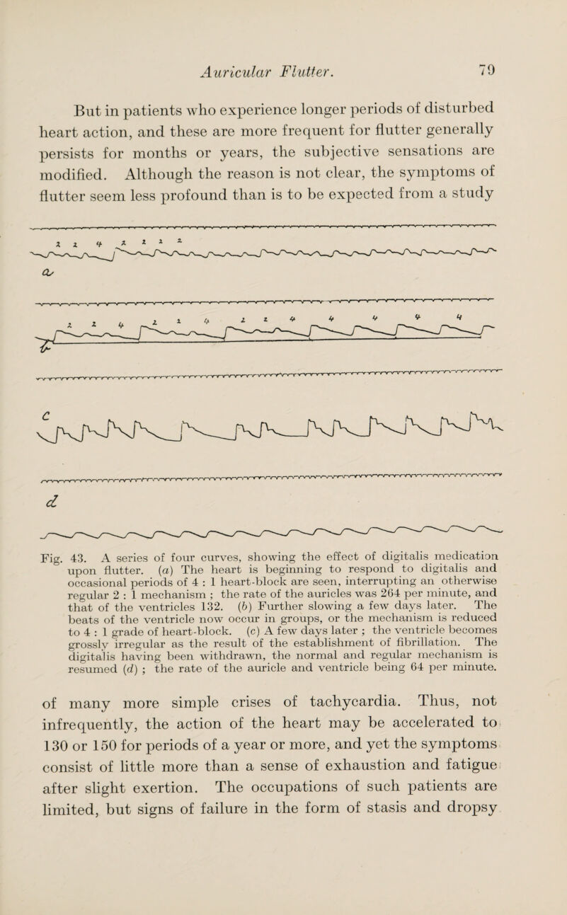 But in patients who experience longer periods of disturbed heart action, and these are more frequent for flutter generally persists for months or years, the subjective sensations are modified. Although the reason is not clear, the symptoms of flutter seem less profound than is to be expected from a study Os d Fig. 43. A series of four curves, showing the effect of digitalis medication upon flutter, (a) The heart is beginning to respond to digitalis and occasional periods of 4 : 1 heart-block are seen, interrupting an otherwise regular 2 : 1 mechanism ; the rate of the amides was 264 per minute, and that of the ventricles 132. (b) Further slowing a few days later. The beats of the ventricle now occur in groups, or the mechanism is reduced to 4 : 1 grade of heart-block, (c) A few days later ; the ventricle becomes grossly irregular as the result of the establishment of fibrillation. The digitalis having been withdrawn, the normal and regular mechanism is resumed (d) ; the rate of the auricle and ventricle being 64 per minute. of many more simple crises of tachycardia. Thus, not infrequently, the action of the heart may be accelerated to 130 or 150 for periods of a year or more, and yet the symptoms consist of little more than a sense of exhaustion and fatigue after slight exertion. The occupations of such patients are limited, but signs of failure in the form of stasis and dropsy