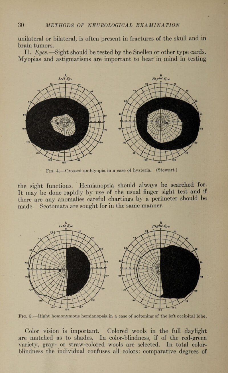 unilateral or bilateral, is often present in fractures of the skull and in brain tumors. II. Eyes.—Sight should be tested by the Snellen or other type cards. Myopias and astigmatisms are important to bear in mind in testing A Irfl Eye o 190 A fitfjKt Eye 0 ISO Fig. 4.—Crossed amblyopia in a case of hysteria. (Stewart.) the sight functions. Hemianopsia should always be searched for. It may be done rapidly by use of the usual finger sight test and if there are any anomalies careful chartings by a perimeter should be made. Scotomata are sought for in the same manner. Fig. 5.—Right homonymous hemianopsia in a case of softening of the left occipital lobe. Color vision is important. Colored wools in the full daylight are matched as to shades. In color-blindness, if of the red-green variety, gray- or straw-colored wools are selected. In total color¬ blindness the individual confuses all colors: comparative degrees of