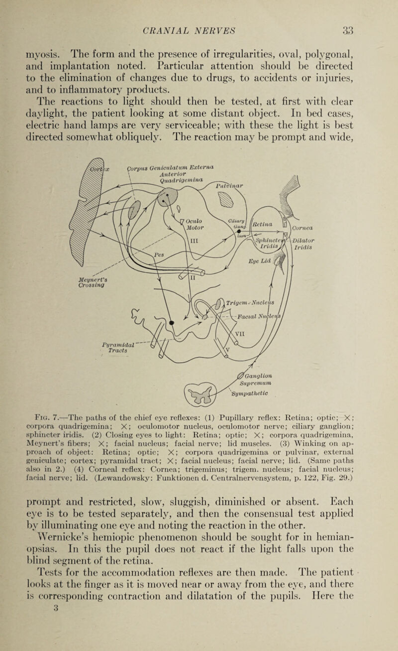 myosis. The form and the presence of irregularities, oval, polygonal, and implantation noted. Particular attention should be directed to the elimination of changes due to drugs, to accidents or injuries, and to inflammatory products. The reactions to light should then be tested, at first with clear daylight, the patient looking at some distant object. In bed cases, electric hand lamps are very serviceable; with these the light is best directed somewhat obliquely. The reaction may be prompt and wide, Fig. 7.—The paths of the chief eye reflexes: (1) Pupillary reflex: Retina; optic; X; corpora quadrigemina; X; oculomotor nucleus, oculomotor nerve; ciliary ganglion; sphincter iridis. (2) Closing eyes to light: Retina; optic; X; corpora quadrigemina, Meynert’s fibers; X; facial nucleus; facial nerve; lid muscles. (3) Winking on ap¬ proach of object: Retina; optic; X; corpora quadrigemina or pulvinar, external geniculate; cortex; pyramidal tract; X; facial nucleus; facial nerve; lid. (Same paths also in 2.) (4) Corneal reflex: Cornea; trigeminus; trigem. nucleus; facial nucleus; facial nerve; lid. (Lewandowsky: Funktionend. Centralnervensystem, p. 122, Fig. 29.) prompt and restricted, slow, sluggish, diminished or absent. Each eye is to be tested separately, and then the consensual test applied by illuminating one eye and noting the reaction in the other. Wernicke’s hemiopic phenomenon should be sought for in hemian- opsias. In this the pupil does not react if the light falls upon the blind segment of the retina. Tests for the accommodation reflexes are then made. The patient looks at the finger as it is moved near or away from the eye, and there is corresponding contraction and dilatation of the pupils. Here the 3