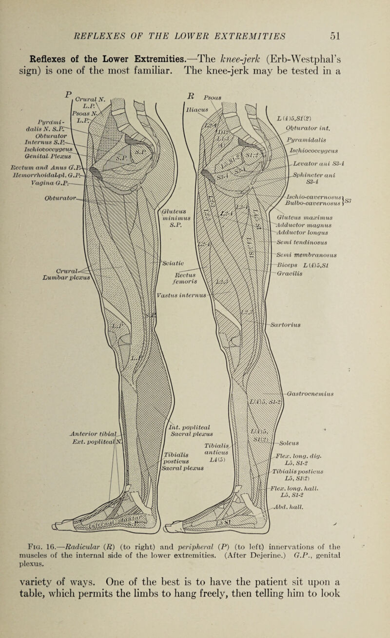 Reflexes of the Lower Extremities.—The knee-jerk (Erb-Westphal’s sign) is one of the most familiar. The knee-jerk may be tested in a R Psoas PyrcCmi- dalis N. S. Obturator Internus S.P.- Iscli iotsoccygeus Genital Plexus Ilectum and Anus G.P.• Jlemorrhoidalpl. G. Vagina G.P: Obturator. Crural Lumbar plexus L (4 )5,S1(2) Obturator int. ramidalis Ischiococcygeus Levator ani S3-4 Sphincter ani S3-4 Ischio-cavemosus\ Bulbo-cavernosus P Gluteus maximus Adductor magnus ~~Adductor longus Semi tendinosus ~Semi membranosus Biceps L(4) 5,SI Gracilis Gastrocnemius Soleus Flex. long. dig. Lo, Sl-2 Tibialis posticus Lo, Sl(2) Flex. long. hall. Lo, Sl-2 Abd. hall. Fig. 1G.—Radicular (R) (to right) and peripheral (P) (to left) innervations of the muscles of the internal side of the lower extremities. (After Dejerine.) G.P., genital plexus. variety of ways. One of the best is to have the patient sit upon a table, which permits the limbs to hang freely, then telling him to look