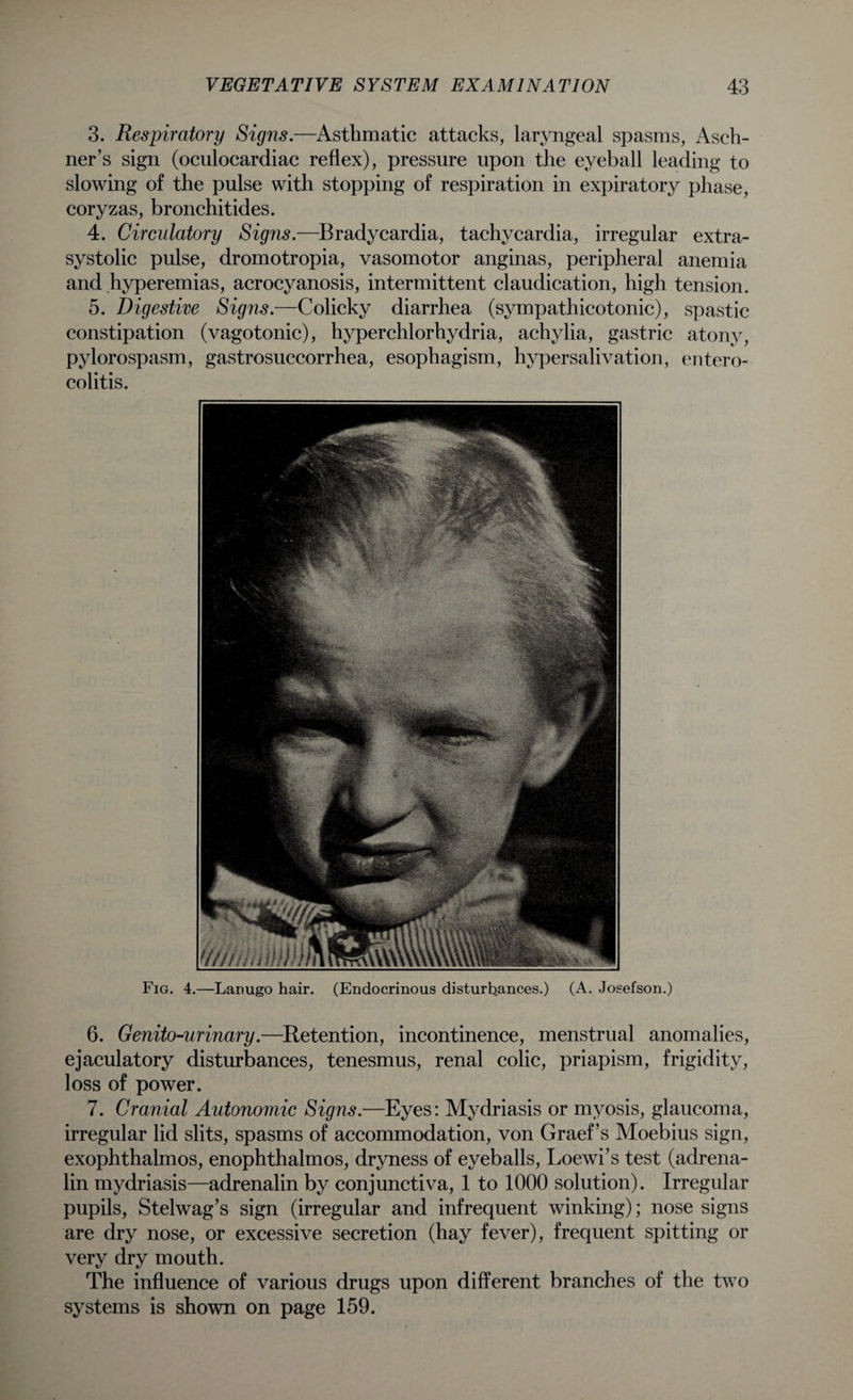 3. Respiratory Signs.—Asthmatic attacks, laryngeal spasms, Asch¬ ner’s sign (oculocardiac reflex), pressure upon the eyeball leading to slowing of the pulse with stopping of respiration in expiratory phase, coryzas, bronchitides. 4. Circulatory Signs.—Bradycardia, tachycardia, irregular extra- systolic pulse, dromotropia, vasomotor anginas, peripheral anemia and hyperemias, acrocyanosis, intermittent claudication, high tension. 5. Digestive Signs.—Colicky diarrhea (sympathicotonic), spastic constipation (vagotonic), hyperchlorhydria, achylia, gastric atony, pylorospasm, gastrosuccorrhea, esophagism, hyper salivation, entero¬ colitis. Fig. 4.—Lanugo hair. (Endocrinous disturbances.) (A. Josefson.) 6. Genito-urinary.—Retention, incontinence, menstrual anomalies, ejaculatory disturbances, tenesmus, renal colic, priapism, frigidity, loss of power. 7. Cranial Autonomic Signs.—Eyes: Mydriasis or myosis, glaucoma, irregular lid slits, spasms of accommodation, von Graef’s Moebius sign, exophthalmos, enophthalmos, dryness of eyeballs, Loewi’s test (adrena¬ lin mydriasis—adrenalin by conjunctiva, 1 to 1000 solution). Irregular pupils, Stelwag’s sign (irregular and infrequent winking); nose signs are dry nose, or excessive secretion (hay fever), frequent spitting or very dry mouth. The influence of various drugs upon different branches of the two systems is shown on page 159.