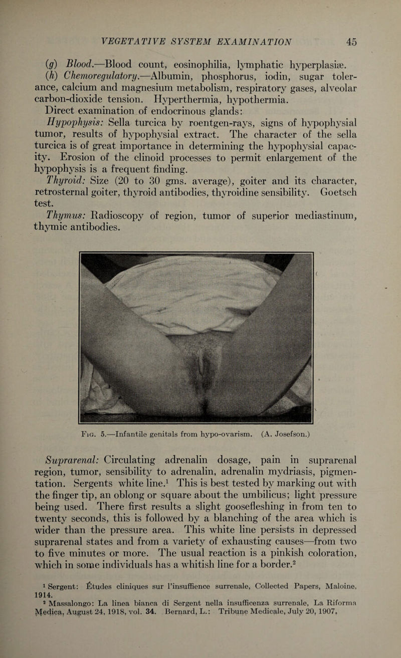 (,g) Blood.—Blood count, eosinophilia, lymphatic hyperplasia. (h) Chevioregulatory.—Albumin, phosphorus, iodin, sugar toler¬ ance, calcium and magnesium metabolism, respiratory gases, alveolar carbon-dioxide tension. Hyperthermia, hypothermia. Direct examination of endocrinous glands: Hypophysis: Sella turcica by roentgen-rays, signs of hypophysial tumor, results of hypophysial extract. The character of the sella turcica is of great importance in determining the hypophysial capac¬ ity. Erosion of the clinoid processes to permit enlargement of the hypophysis is a frequent finding. Thyroid: Size (20 to 30 gms. average), goiter and its character, retrosternal goiter, thyroid antibodies, thyroidine sensibility. Goetsch test. Thymus: Radioscopy of region, tumor of superior mediastinum, thymic antibodies. Fig. 5.—Infantile genitals from hypo-ovarism. (A. Josefson.) Suprarenal: Circulating adrenalin dosage, pain in suprarenal region, tumor, sensibility to adrenalin, adrenalin mydriasis, pigmen¬ tation. Sergents white line.1 This is best tested by marking out with the finger tip, an oblong or square about the umbilicus; light pressure being used. There first results a slight goosefleshing in from ten to twenty seconds, this is followed by a blanching of the area which is wider than the pressure area. This white line persists in depressed suprarenal states and from a variety of exhausting causes—from two to five minutes or more. The usual reaction is a pinkish coloration, which in some individuals has a whitish line for a border.2 1 Sergent: Etudes cliniques sur l’insuffience surrenale, Collected Papers, Maloine, 1914. 2 Massalongo: La linea bianca di Sergent nella insufficenza surrenale, La Riforma Medica, August 24, 1918, vol. 34. Bernard, L.: Tribune Medicale, July 20, 1907.