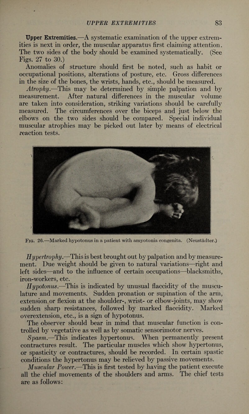 Upper Extremities.—A systematic examination of the upper extrem¬ ities is next in order, the muscular apparatus first claiming attention. The two sides of the body should be examined systematically. (See Figs. 27 to 30.) Anomalies of structure should first be noted, such as habit or occupational positions, alterations of posture, etc. Gross differences in the size of the bones, the wrists, hands, etc., should be measured. Atrophy.—This may be determined by simple palpation and by measurement. After natural differences in the muscular volume are taken into consideration, striking variations should be carefully measured. The circumferences over the biceps and just below the elbows on the two sides should be compared. Special individual muscular atrophies may be picked out later by means of electrical reaction tests. Fig. 26.—Marked hypotonus in a patient with amyotonia congenita. (Neustadter.) Hypertrophy.—This is best brought out by palpation and by measure¬ ment. Due weight should be given to natural variations—right and left sides—and to the influence of certain occupations—blacksmiths, iron-workers, etc. Hypotonus.—This is indicated by unusual flaccidity of the muscu¬ lature and movements. Sudden pronation or supination of the arm, extension or flexion at the shoulder-, wrist- or elbow-joints, may show sudden sharp resistances, followed by marked flaccidity. Marked overextension, etc., is a sign of hypotonus. The observer should bear in mind that muscular function is con¬ trolled by vegetative as well as by somatic sensorimotor nerves. Spasm.—This indicates hypertonus. When permanently present contractures result. The particular muscles which show hypertonus, or spasticity or contractures, should be recorded. In certain spastic conditions the hypertonus may be relieved by passive movements. Muscular Power.—This is first tested by having the patient execute all the chief movements of the shoulders and arms. The chief tests are as follows: