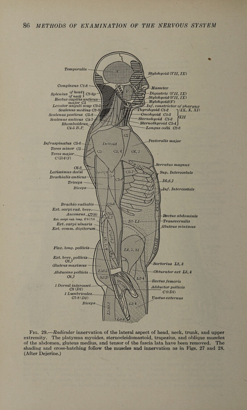 Temporalis Complexus Cl-8 Splenius °j-£eck} C2'8p Rectus capitis anticus major Cl Levator annuli scap C3-5 Scalenus medius C2-8, Scalenus posticus C5-8 Scalenus anticus Cl-7 Rhomboideus, C4-5 B.P. Infraspinatus C5-6- Teres minor Co - Teres major_ C (5)6(7) C6-8_ Latissimus dorsi Brachialis anticus - Triceps Biceps- Thyrohyoid Cl-2 Omohyoid Cl-3 Sternohyoid Cl-3 Sternothyroid Cl-4 Longus colli C2-8 Pectoralis major Stylohyoid (VII, IX) -Masse ter -Diy as trie (VII, IX) -Stylohyoid (VII, IX) -Mylohyoid(V) -Inf. constrictor of pharynx (IX, X, XI) YXII 'erratus maynus Sup. Intercostals D5,6,7 Inf. Intercostals Brachio radialis - Ext. carpi rad. brev .- Anconeus _jf}(8) Ext. carpi rad. long. C 6 (7) 8 Ext. carpi ulnaris Ext. comm, digitorum. Flex. long, pollicis- Ext. brev. pollicis- C6,7 Gluteus maximus ■ Abducens pollicis C6,7 1 Dorsal interossei- C8 (Dl) 1 Lumbricales- C7-8 (Dl) -Rectus abdominis -Transversalis JGluteus minimus Biceps- -Sartorius L2, 3 -Obturator ext L3, 4 lectus femoris Adductor pollicis C8(D1) Vastus externus Fig. 29.—Radicular innervation of the lateral aspect of head, neck, trunk, and upper extremity. The platysma myoides, sternocleidomastoid, trapezius, and oblique muscles of the abdomen, gluteus medius, and tensor of the fascia lata have been removed. The shading and cross-hatching follow the muscles and innervation as in Figs. 27 and 28. (After Dejerine.)