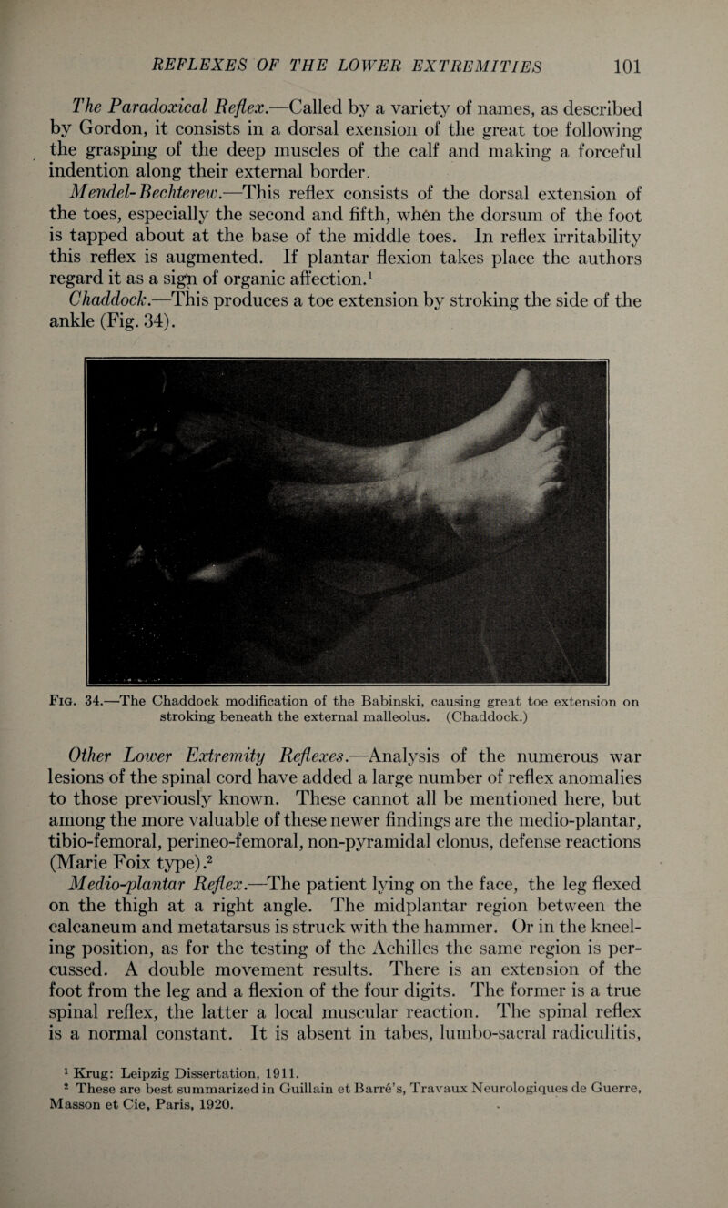 The Paradoxical Beflex.—Called by a variety of names, as described by Gordon, it consists in a dorsal exension of the great toe following the grasping of the deep muscles of the calf and making a forceful indention along their external border. Mendel- Bechterew.—This reflex consists of the dorsal extension of the toes, especially the second and fifth, when the dorsum of the foot is tapped about at the base of the middle toes. In reflex irritability this reflex is augmented. If plantar flexion takes place the authors regard it as a sign of organic affection.1 Chaddock.—This produces a toe extension by stroking the side of the ankle (Fig. 34). Fig. 34.—The Chaddock modification of the Babinski, causing great toe extension on stroking beneath the external malleolus. (Chaddock.) Other Lower Extremity Reflexes.—Analysis of the numerous war lesions of the spinal cord have added a large number of reflex anomalies to those previously known. These cannot all be mentioned here, but among the more valuable of these newer findings are the medio-plantar, tibio-femoral, perineo-femoral, non-pyramidal clonus, defense reactions (Marie Foix type).2 Medio-plantar Reflex.—The patient lying on the face, the leg flexed on the thigh at a right angle. The midplantar region between the calcaneum and metatarsus is struck with the hammer. Or in the kneel¬ ing position, as for the testing of the Achilles the same region is per¬ cussed. A double movement results. There is an extension of the foot from the leg and a flexion of the four digits. The former is a true spinal reflex, the latter a local muscular reaction. The spinal reflex is a normal constant. It is absent in tabes, lumbo-sacral radiculitis, 1 Krug: Leipzig Dissertation, 1911. 2 These are best summarized in Guillain et Barre’s, Travaux Neurologiques de Guerre, Masson et Cie, Paris, 1920.