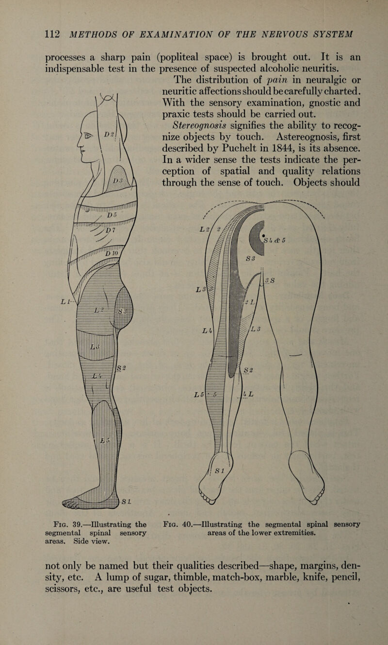 processes a sharp pain (popliteal space) is brought out. It is an indispensable test in the presence of suspected alcoholic neuritis. The distribution of pain in neuralgic or neuritic affections should be carefully charted. With the sensory examination, gnostic and praxic tests should be carried out. Stereo gnosis signifies the ability to recog¬ nize objects by touch. Astereognosis, first described by Puchelt in 1844, is its absence. In a wider sense the tests indicate the per¬ ception of spatial and quality relations through the sense of touch. Objects should Fig. 39.—Illustrating the segmental spinal sensory- areas. Side view. Fig. 40.—Illustrating the segmental spinal sensory areas of the lower extremities. not only be named but their qualities described—shape, margins, den¬ sity, etc. A lump of sugar, thimble, match-box, marble, knife, pencil, scissors, etc., are useful test objects.