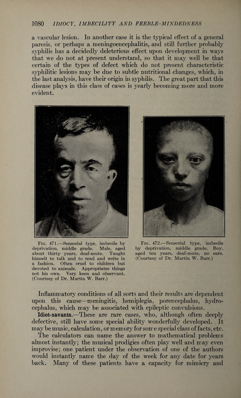 a vascular lesion. In another case it is the typical effect of a general paresis, or perhaps a meningoencephalitis, and still further probably syphilis has a decidedly deleterious effect upon development in ways that we do not at present understand, so that it may well be that certain of the types of defect which do not present characteristic syphilitic lesions may be due to subtle nutritional changes, which, in the last analysis, have their origin in syphilis. The great part that this disease plays in this class of cases is yearly becoming more and more evident. Fig. 471.—Sensorial type, imbecile by deprivation, middle grade. Male, aged about thirty years, deaf-mute. Taught himseli to talk and to read and write in a fashion. Often cruel to children but devoted to animals. Appropriates things not his own. Very keen and observant. (Courtesy of Dr. Martin W. Barr.) Fig. 472.—Sensorial type, imbecile by deprivation, middle grade. Boy, aged ten years, deaf-mute, no ears. (Courtesy of Dr. Martin W. Barr.) Inflammatory conditions of all sorts and their results are dependent upon this cause—meningitis, hemiplegia, porencephalus, hydro¬ cephalus, which may be associated with epileptic convulsions. Idiot-savants.—These are rare cases, who, although often deeply defective, still have some special ability wonderfully developed. It may be music, calculation, or memory for some special class of facts, etc. The calculators can name the answer to mathematical problems almost instantly; the musical prodigies often play well and may even improvise; one patient under the observation of one of the authors would instantly name the day of the week for any date for years back. Many of these patients have a capacity for mimicry and