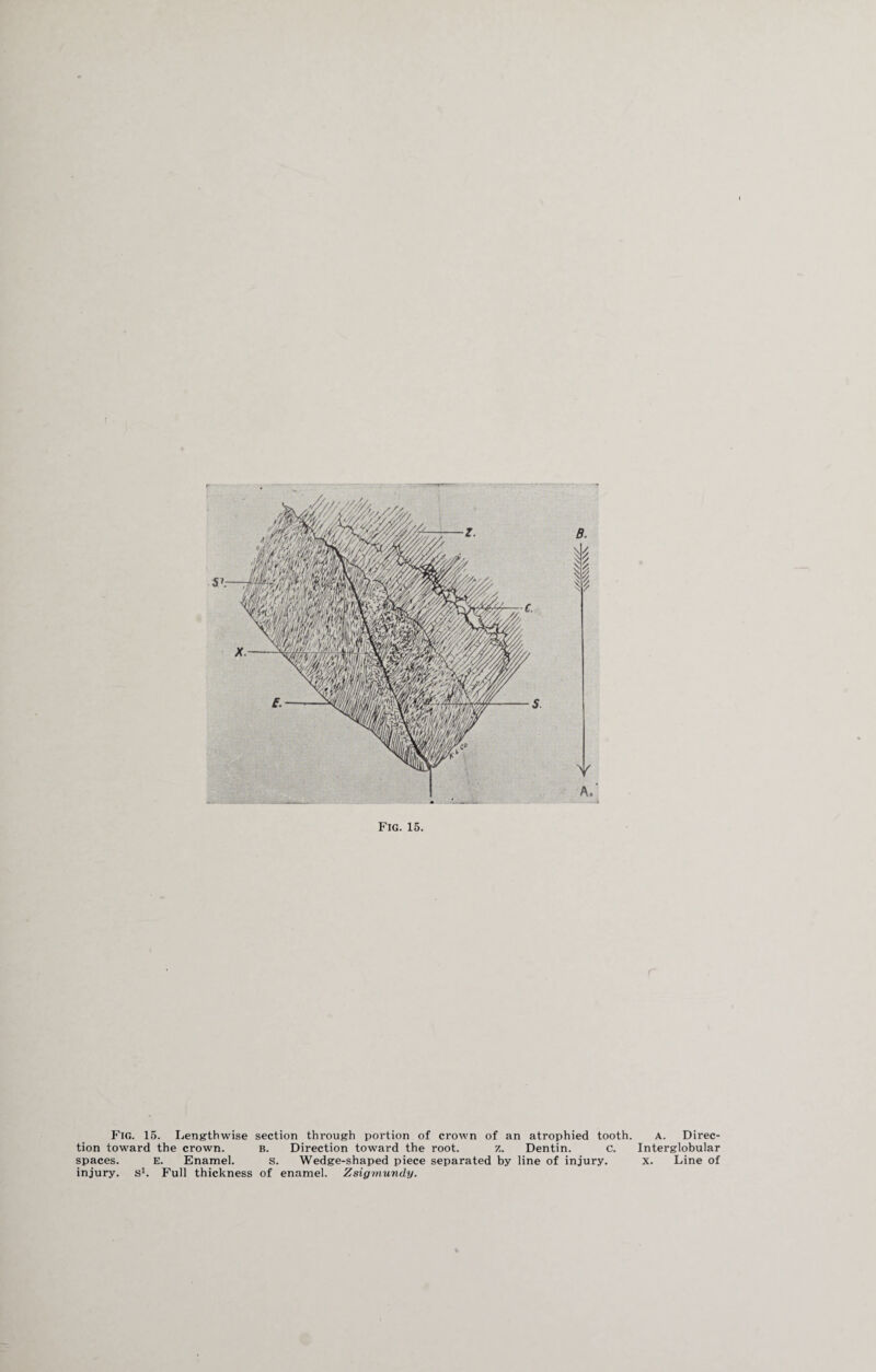 tion toward the crown. b. Direction toward the root. z. Dentin. c. spaces. E. Enamel. s. Wedge-shaped piece separated by line of injury, injury, s1. Full thickness of enamel. Zsigmundy. Interglobular x. Line of