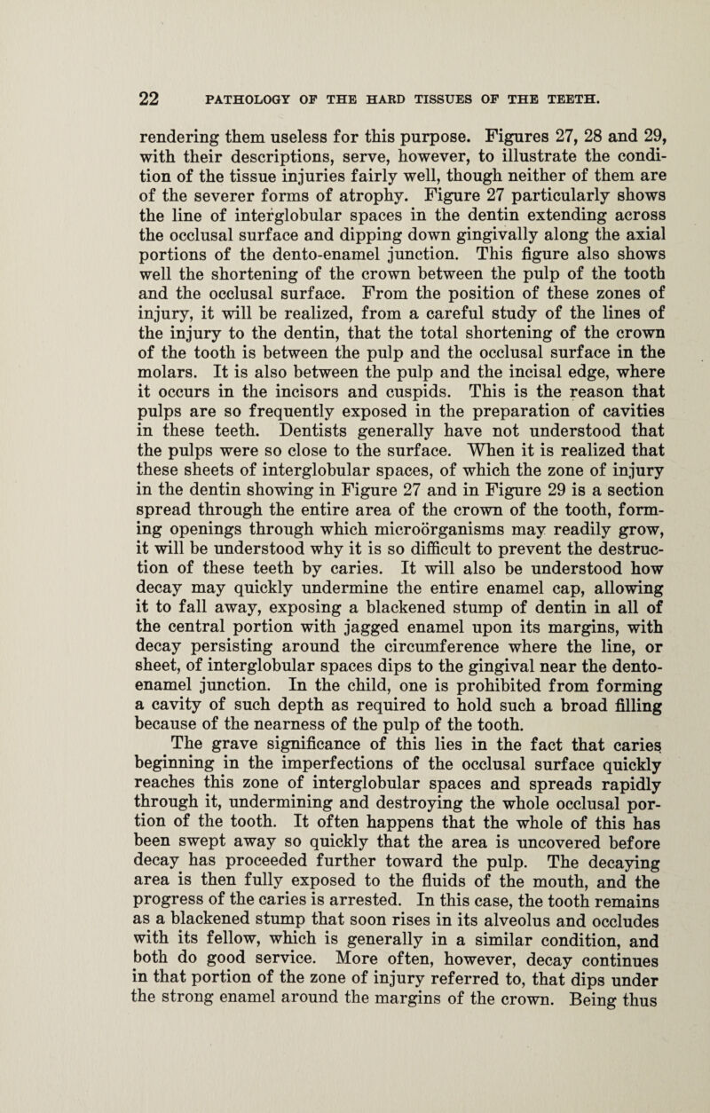 rendering them useless for this purpose. Figures 27, 28 and 29, with their descriptions, serve, however, to illustrate the condi¬ tion of the tissue injuries fairly well, though neither of them are of the severer forms of atrophy. Figure 27 particularly shows the line of interglobular spaces in the dentin extending across the occlusal surface and dipping down gingivally along the axial portions of the dento-enamel junction. This figure also shows well the shortening of the crown between the pulp of the tooth and the occlusal surface. From the position of these zones of injury, it will be realized, from a careful study of the lines of the injury to the dentin, that the total shortening of the crown of the tooth is between the pulp and the occlusal surface in the molars. It is also between the pulp and the incisal edge, where it occurs in the incisors and cuspids. This is the reason that pulps are so frequently exposed in the preparation of cavities in these teeth. Dentists generally have not understood that the pulps were so close to the surface. When it is realized that these sheets of interglobular spaces, of which the zone of injury in the dentin showing in Figure 27 and in Figure 29 is a section spread through the entire area of the crown of the tooth, form¬ ing openings through which microorganisms may readily grow, it will be understood why it is so difficult to prevent the destruc¬ tion of these teeth by caries. It will also be understood how decay may quickly undermine the entire enamel cap, allowing it to fall away, exposing a blackened stump of dentin in all of the central portion with jagged enamel upon its margins, with decay persisting around the circumference where the line, or sheet, of interglobular spaces dips to the gingival near the dento- enamel junction. In the child, one is prohibited from forming a cavity of such depth as required to hold such a broad filling because of the nearness of the pulp of the tooth. The grave significance of this lies in the fact that caries beginning in the imperfections of the occlusal surface quickly reaches this zone of interglobular spaces and spreads rapidly through it, undermining and destroying the whole occlusal por¬ tion of the tooth. It often happens that the whole of this has been swept away so quickly that the area is uncovered before decay has proceeded further toward the pulp. The decaying area is then fully exposed to the fluids of the mouth, and the progress of the caries is arrested. In this case, the tooth remains as a blackened stump that soon rises in its alveolus and occludes with its fellow, which is generally in a similar condition, and both do good service. More often, however, decay continues in that portion of the zone of injury referred to, that dips under the strong enamel around the margins of the crown. Being thus