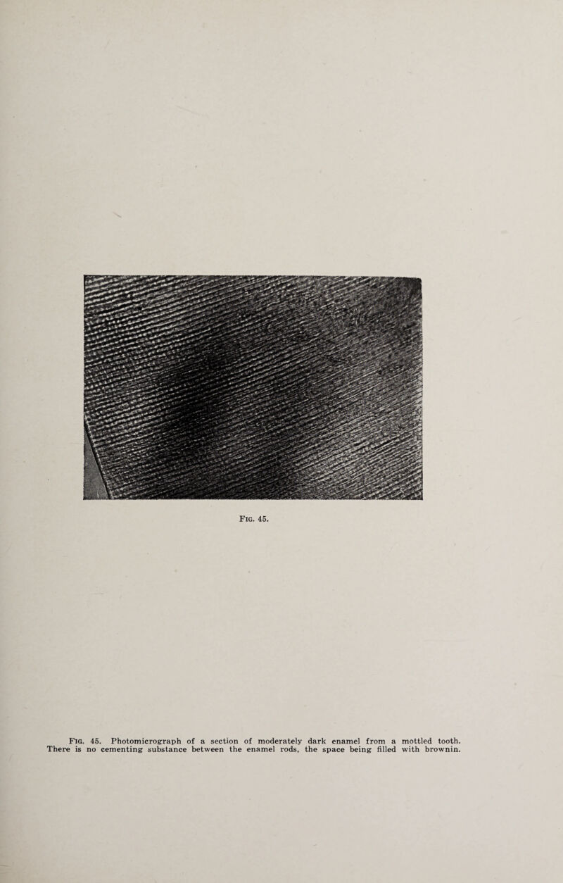 Fig. 45. Photomicrograph of a section of moderately dark enamel from a mottled tooth. There is no cementing substance between the enamel rods, the space being filled with brownin.