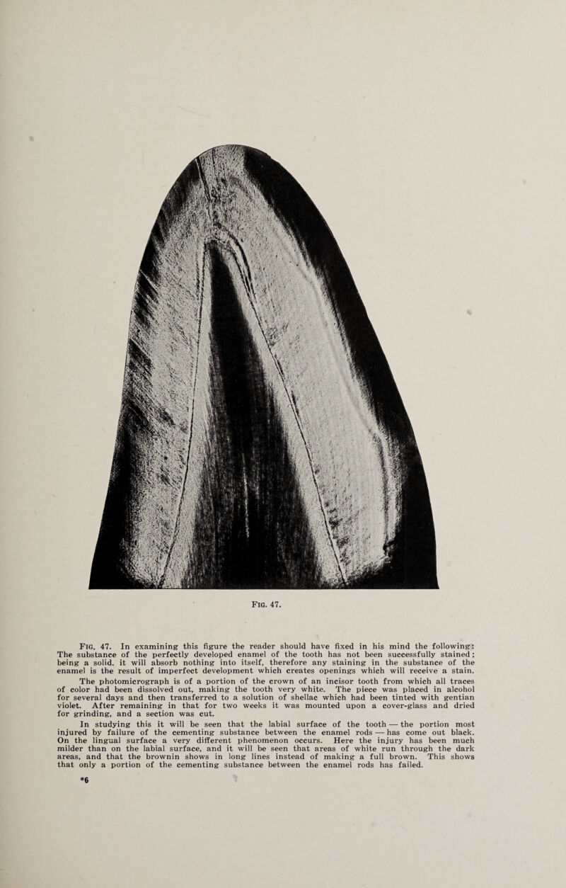 Fig. 47. In examining this figure the reader should have fixed in his mind the following: The substance of the perfectly developed enamel of the tooth has not been successfully stained; being a solid, it will absorb nothing into itself, therefore any staining in the substance of the enamel is the result of imperfect development which creates openings which will receive a stain. The photomicrograph is of a portion of the crown of an incisor tooth from which all traces of color had been dissolved out, making the tooth very white. The piece was placed in alcohol for several days and then transferred to a solution of shellac which had been tinted with gentian violet. After remaining in that for two weeks it was mounted upon a cover-glass and dried for grinding, and a section was cut. In studying this it will be seen that the labial surface of the tooth — the portion most injured by failure of the cementing substance between the enamel rods — has come out black. On the lingual surface a very different phenomenon occurs. Here the injury has been much milder than on the labial surface, and it will be seen that areas of white run through the dark areas, and that the brownin shows in long lines instead of making a full brown. This shows that only a portion of the cementing substance between the enamel rods has failed. *6