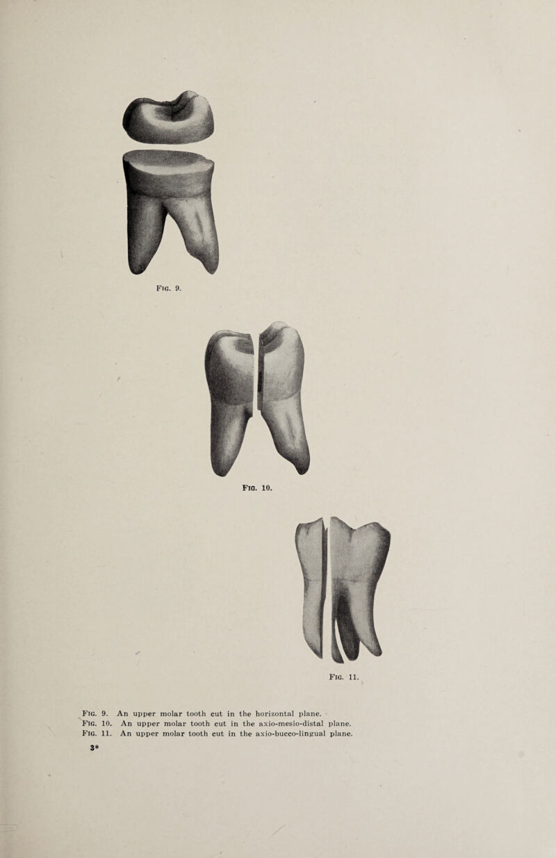 Fig. 10. Fig. 11. Fig. 9. An upper molar tooth cut in the horizontal plane. Fig. 10. An upper molar tooth cut in the axio-mesio-distal plane. Fig. 11. An upper molar tooth cut in the axio-bucco-lingual plane. 3*